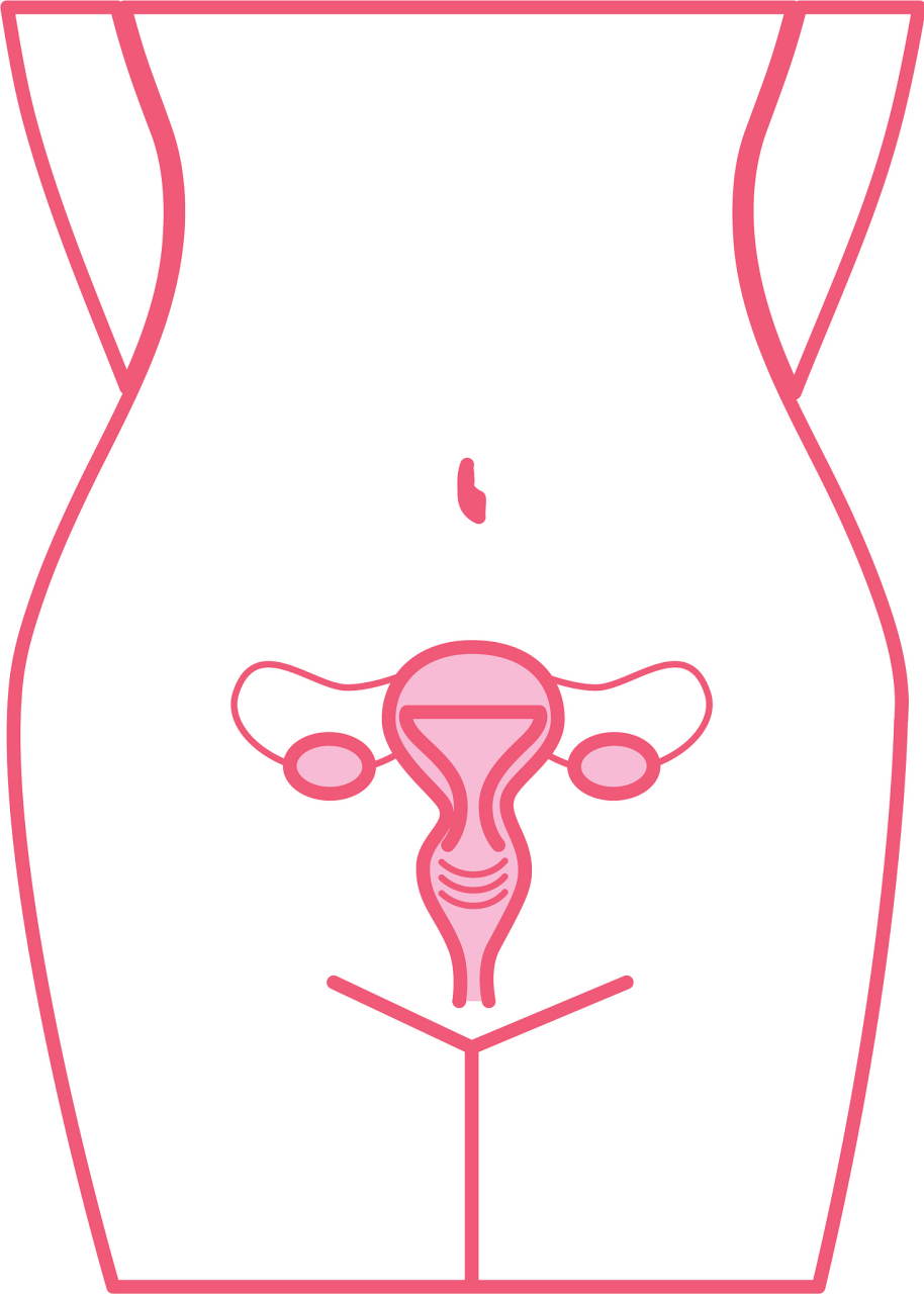 附件炎,作为女性常见的妇科炎症之一,往往引起女性朋友的担忧.