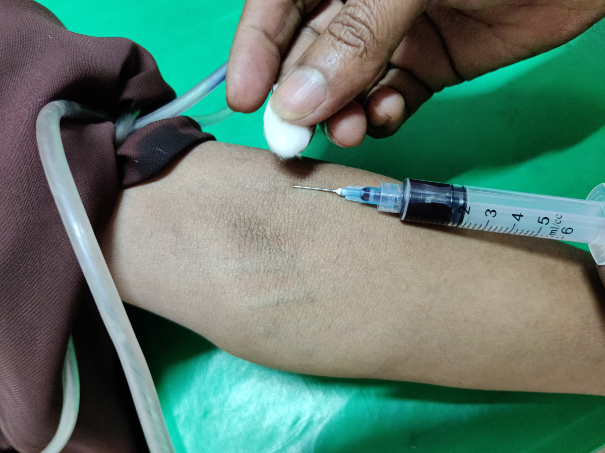 北京大学第六医院穿刺预约-北京大学第六医院穿刺预约时间 