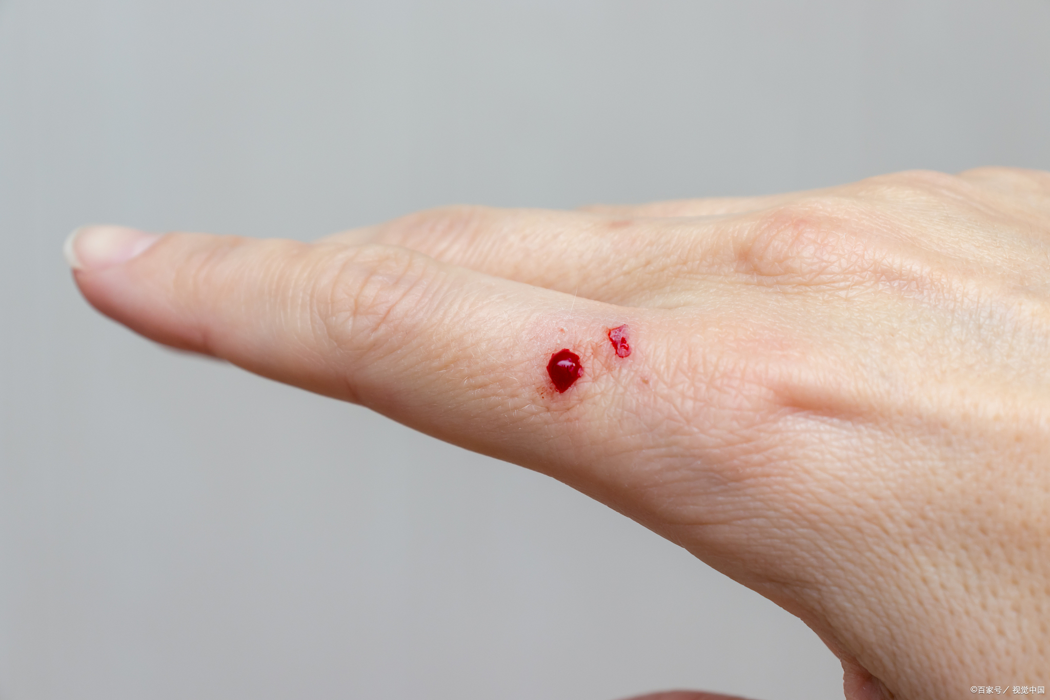 半夜翻垃圾桶被老鼠突袭?手指头瞬间见血!