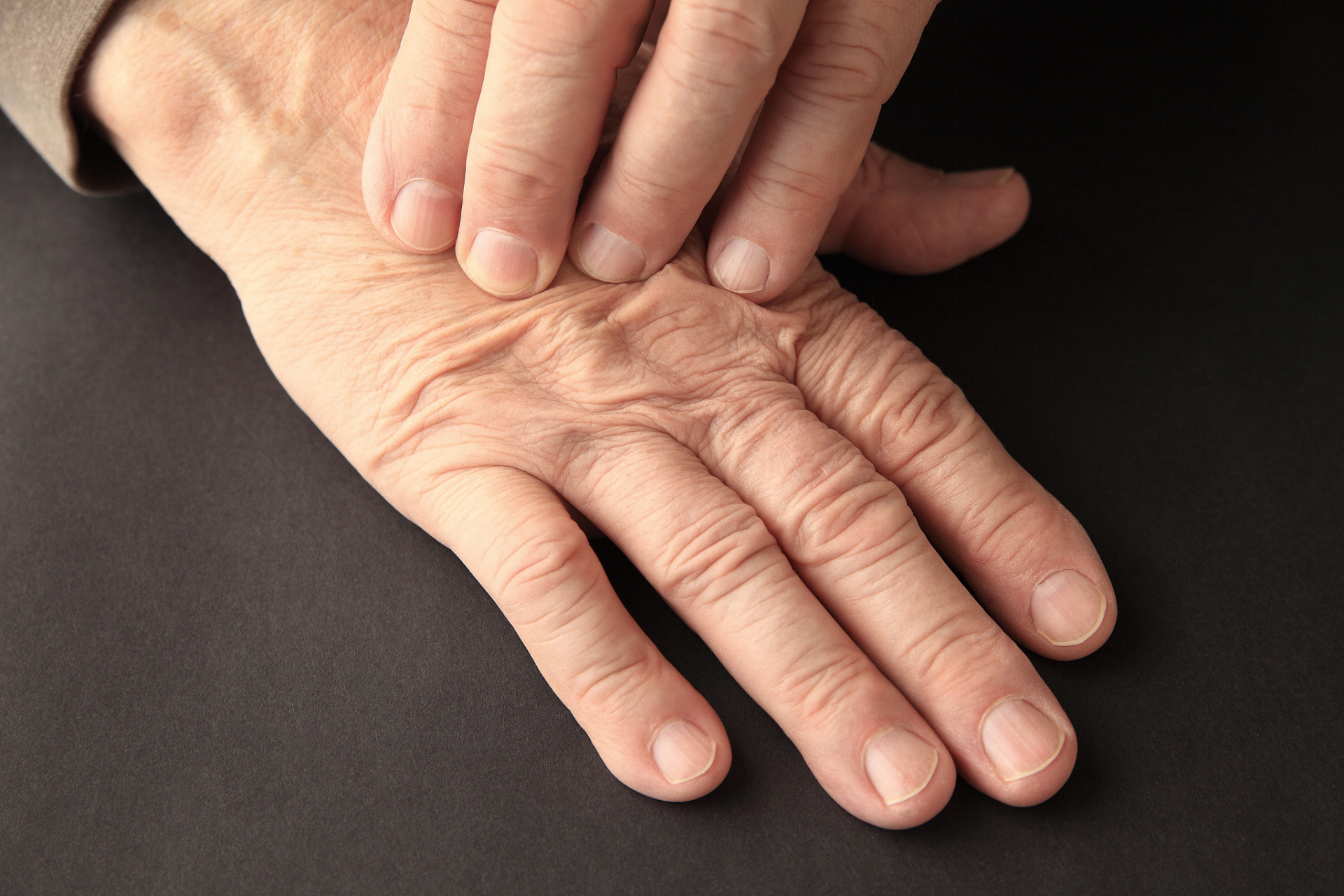 泡水手指起皱纹#   手部皱纹和粗糙产生的原因与我们的生活息息相 ..