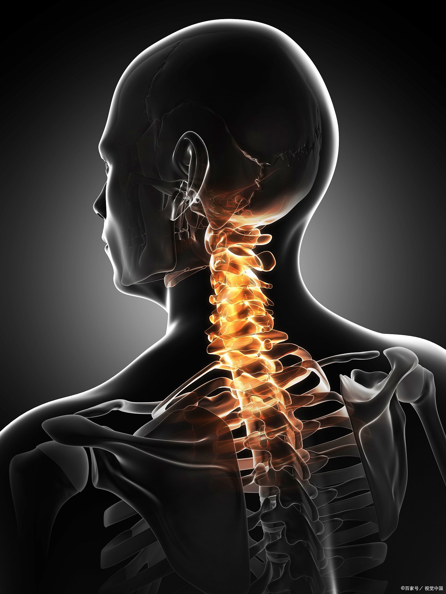 当心颈椎反弓伤神经!