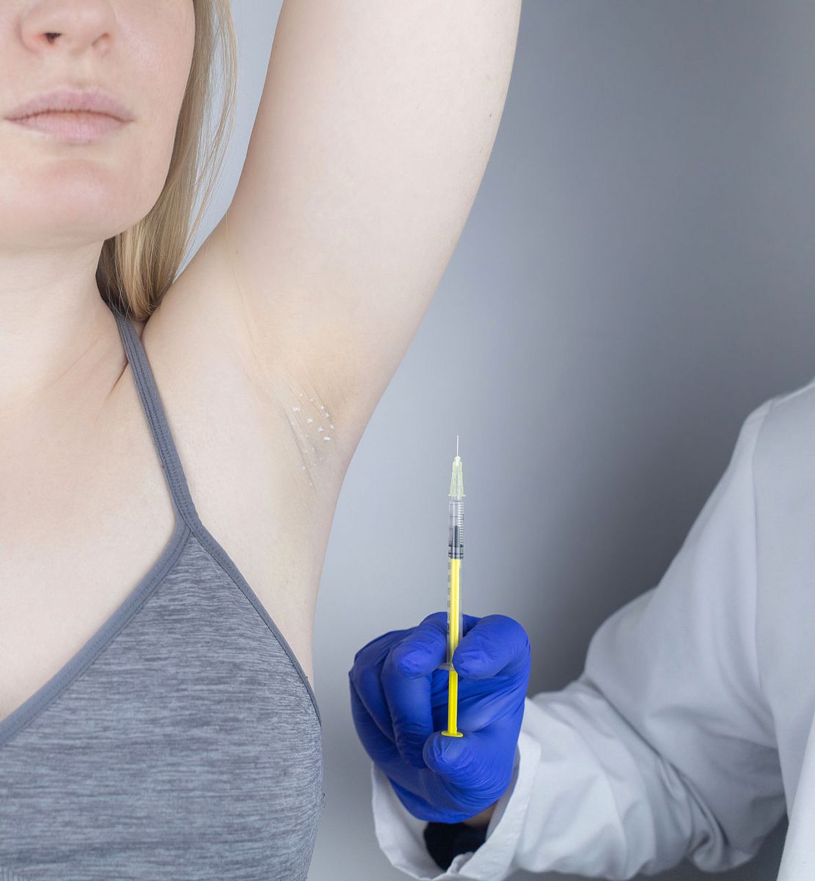 如何去除腋下毛?