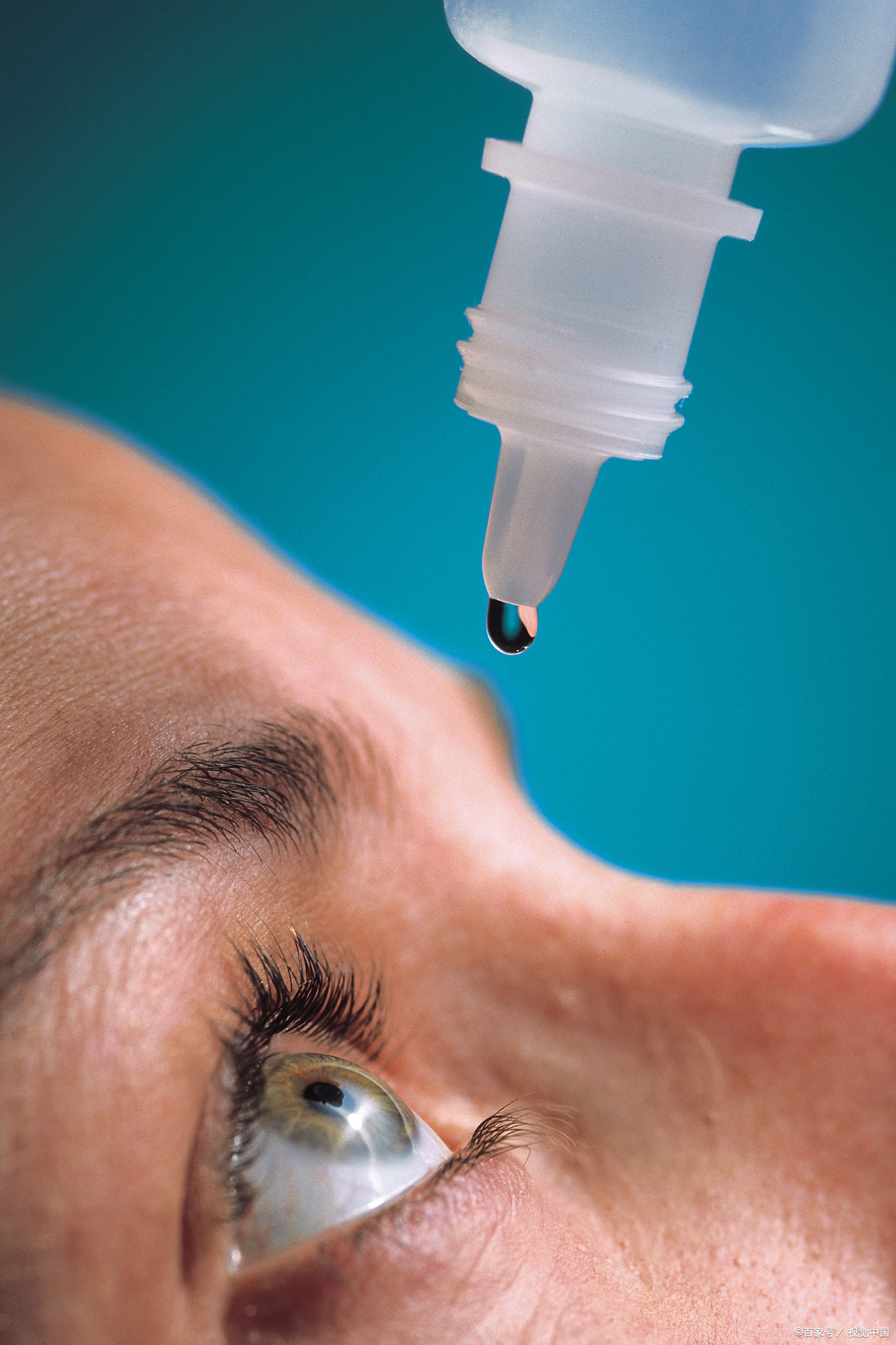 干眼症做脉冲手术大全激光运目祛眼疾干眼治疗图片100张玻尿酸滴眼液