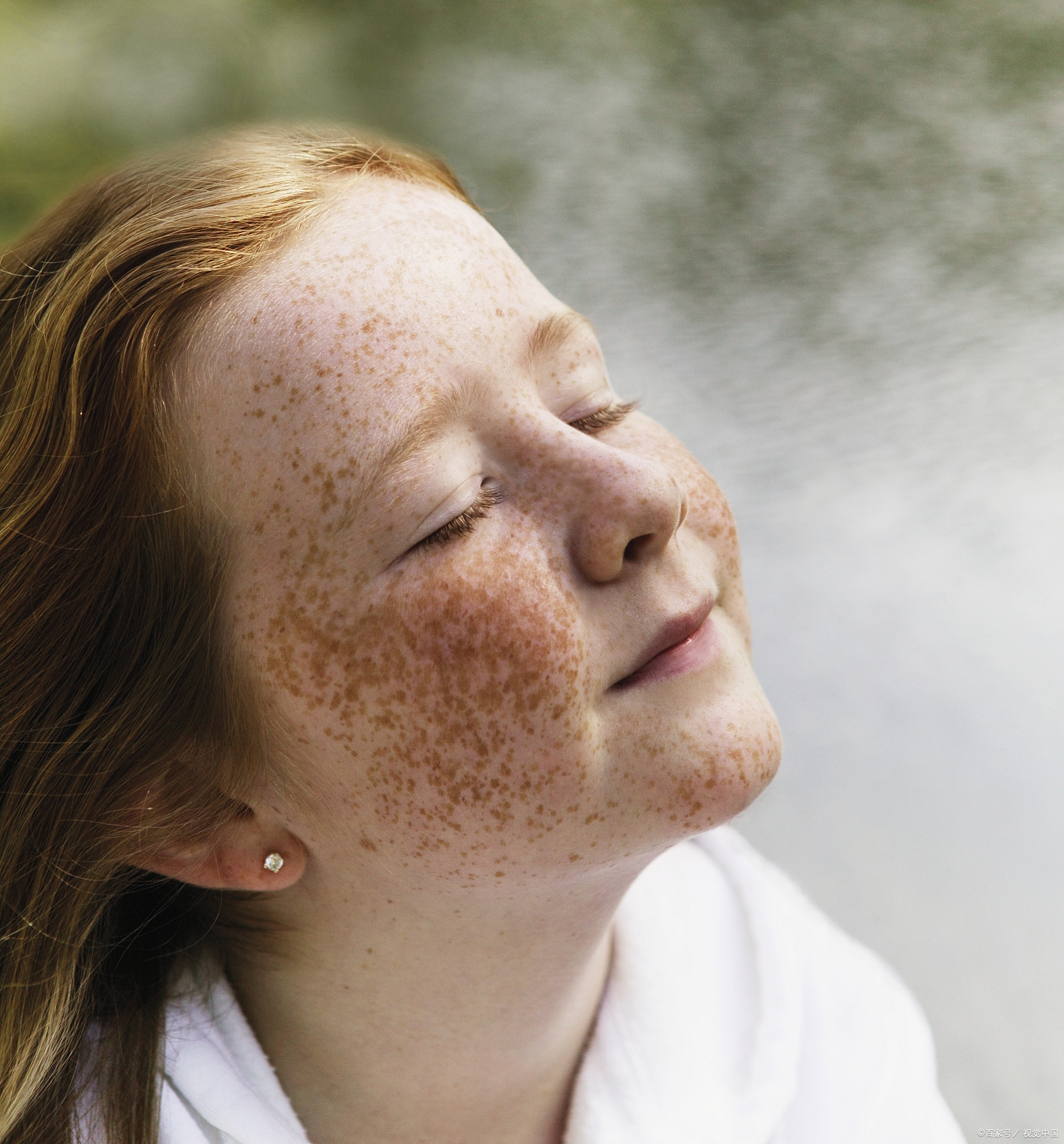 首先啊,我想说,谁还没个"小斑点"呀?咱们的皮肤,就像