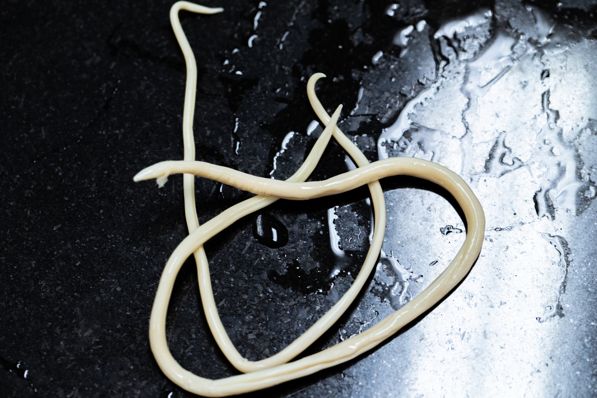 几十年前,人人肚子里几乎都有蛔虫,为何现在很少听说过了?