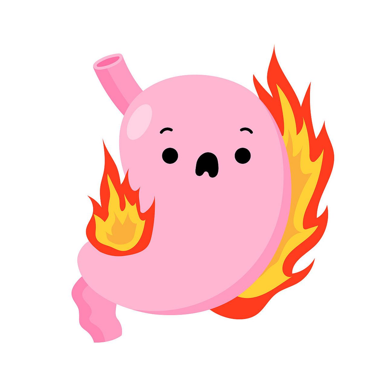 沈阳胃肠医院# #沈阳烧心# 烧心的原因.