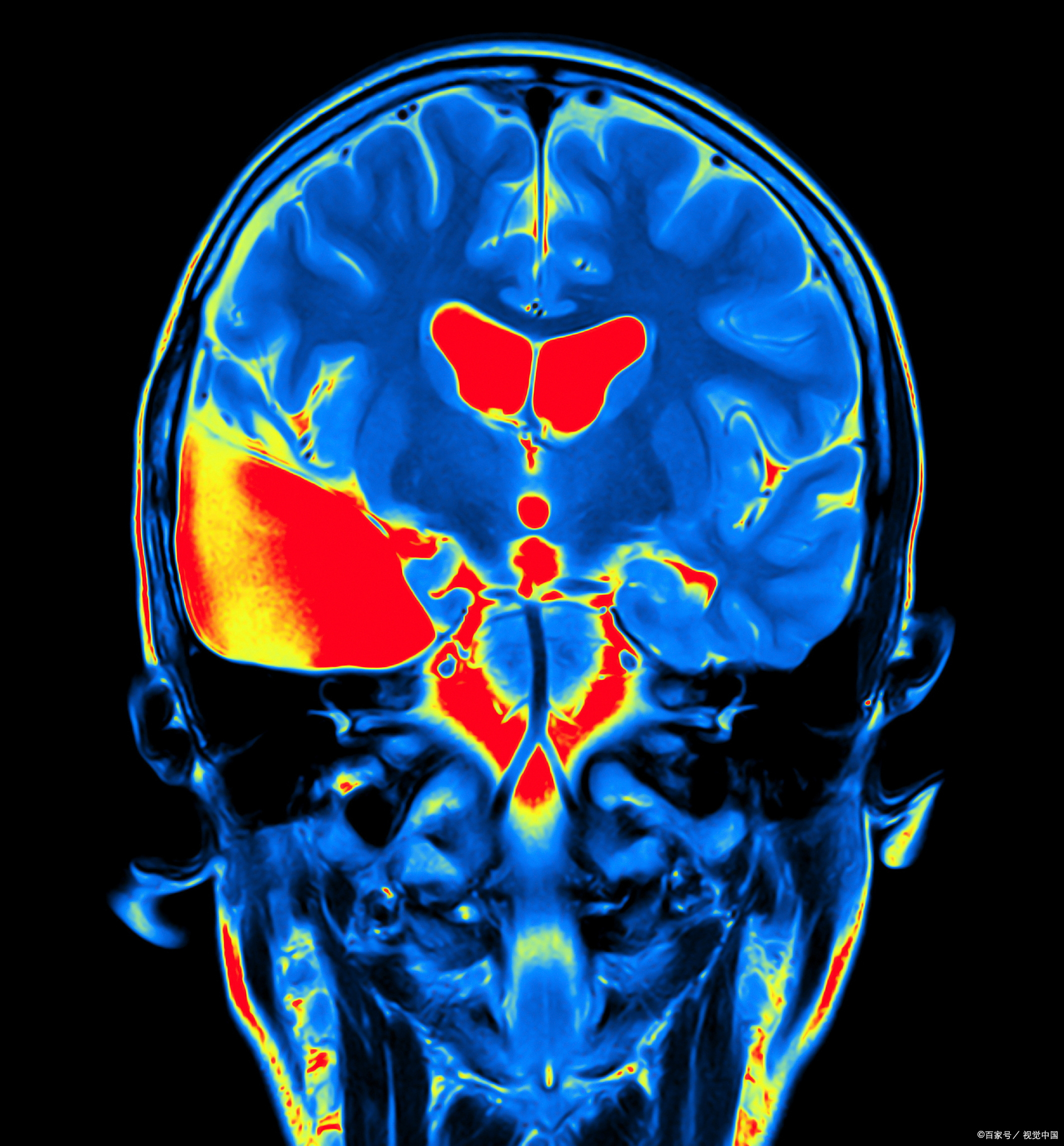 患脑癌儿子被母亲抛弃!