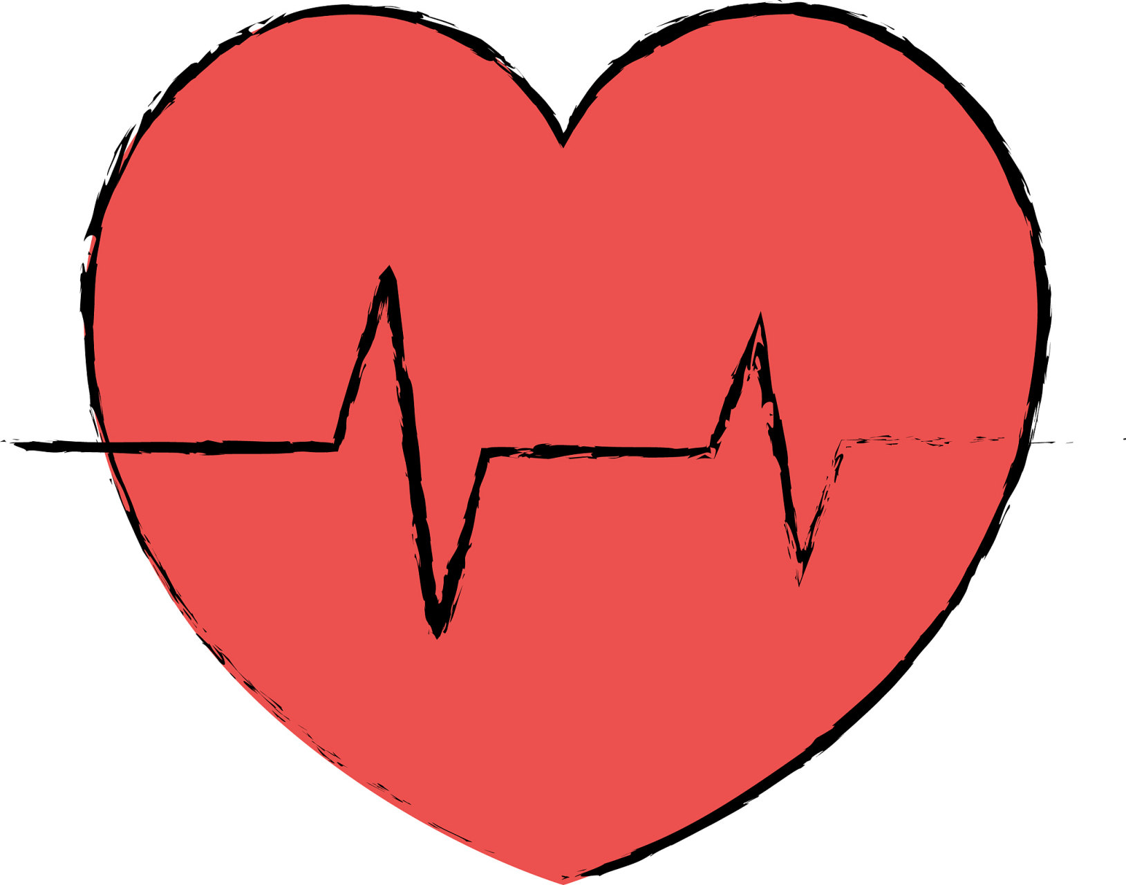 窦性心律不齐,是什么意思  不少人在做完心电图检查后,报告上会写窦性