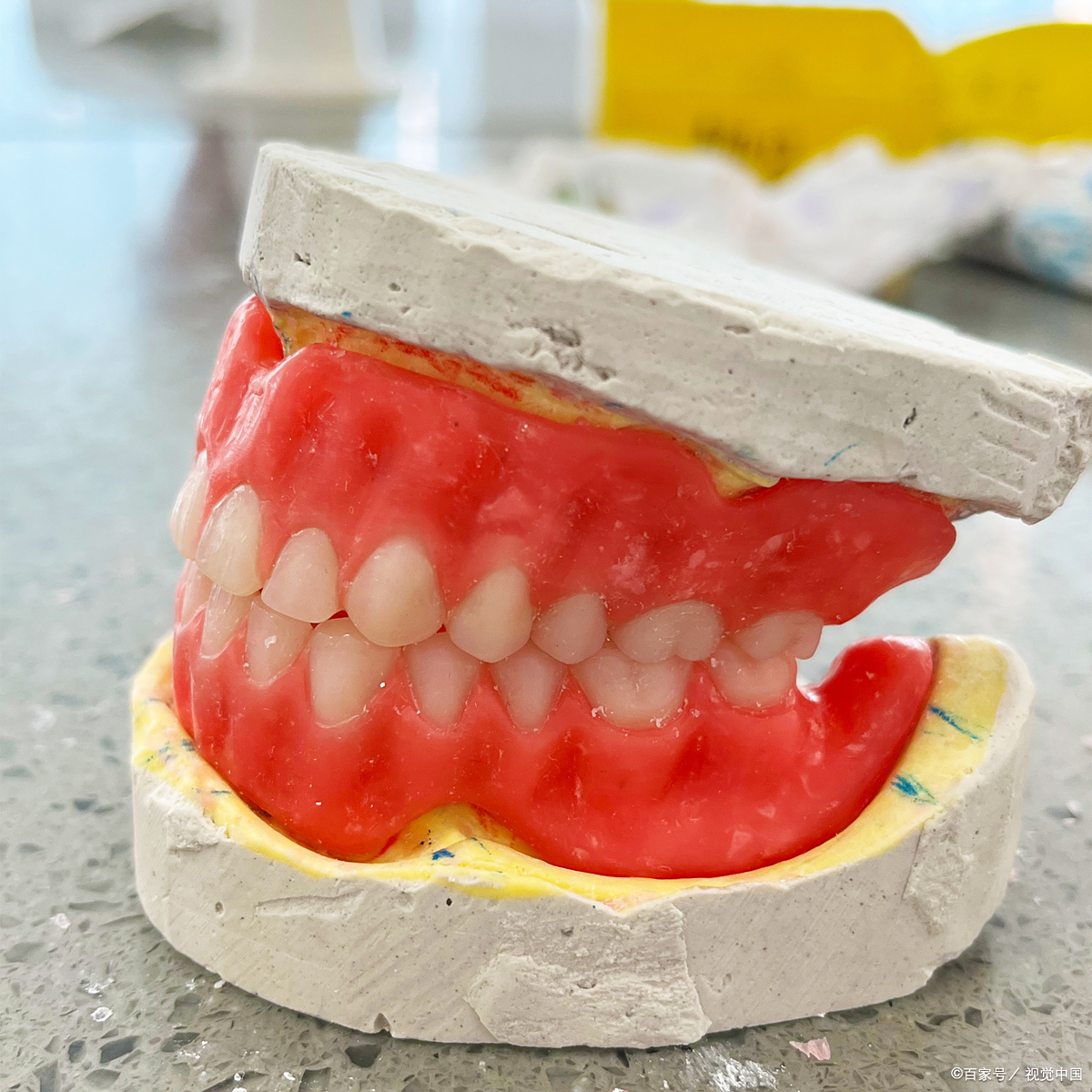 牙槽骨薄能做牙齿矫正吗?