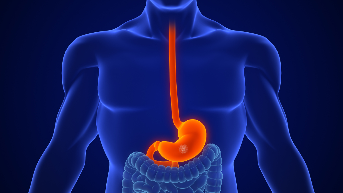 【老胃病的人建议多注意这4个饮食习惯】 1,宜少