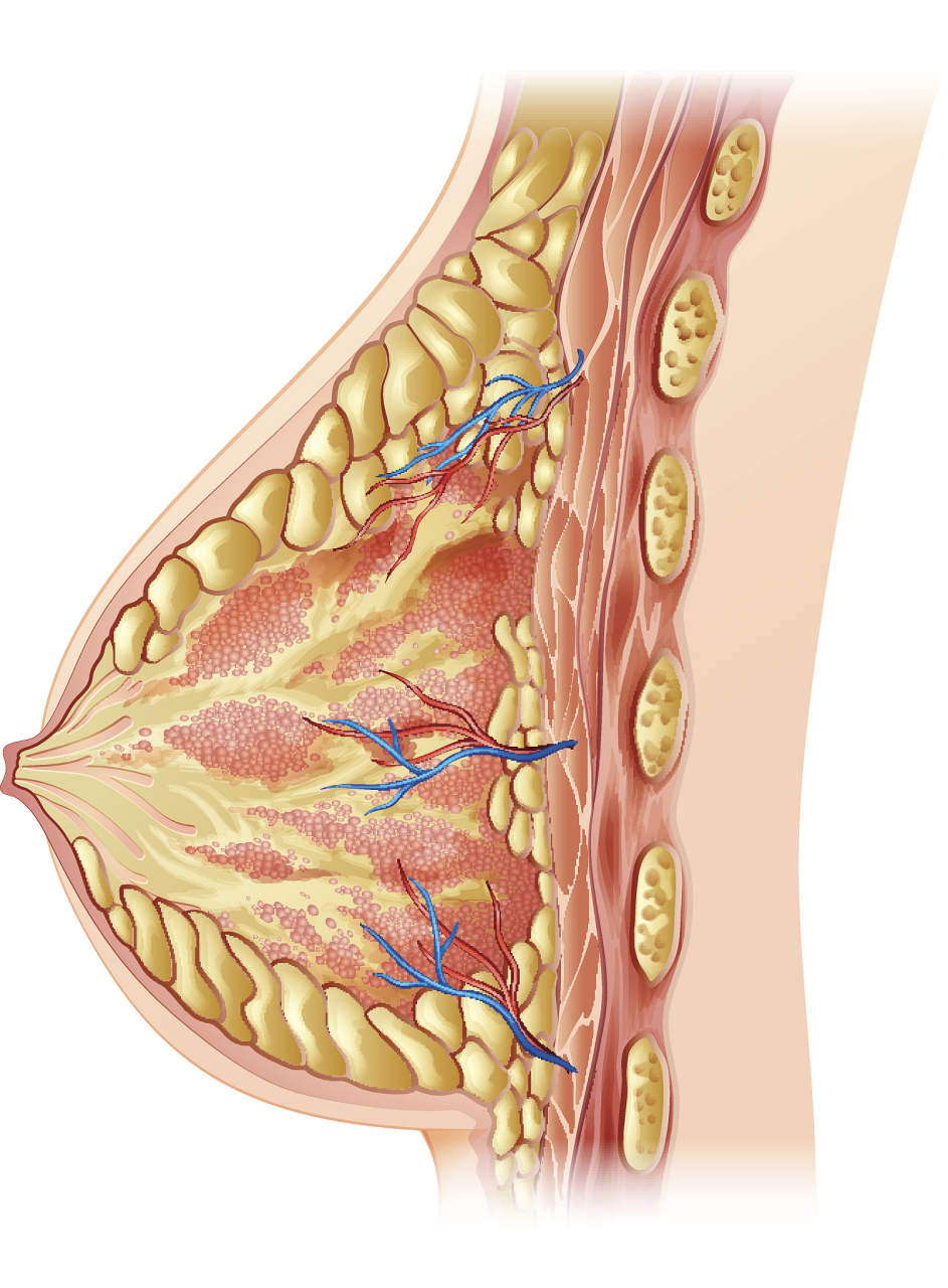 双环法缩胸手术适用于先天性乳房发育过度,巨乳症,乳房下垂等情况.