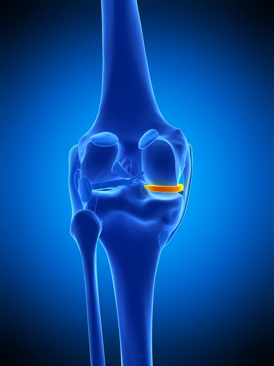 95我要告诉大家的是,半月板损害并非不治之症.