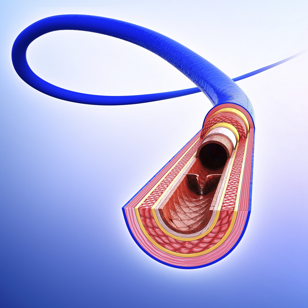 【动脉导管未闭及肺动脉高压如何治疗?