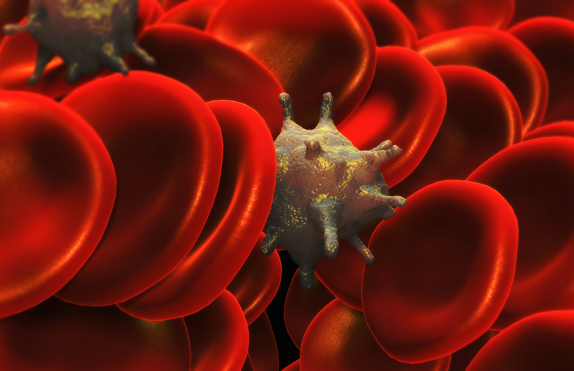 我的诊室故事 55岁的山东阮先生,几年前体检发现全