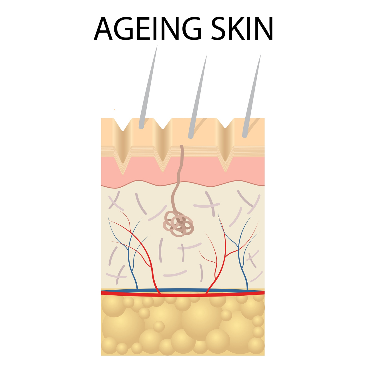 混合型肌肤  混合型肌肤是指t型区皮肤油性,而两颊和下巴部位干燥