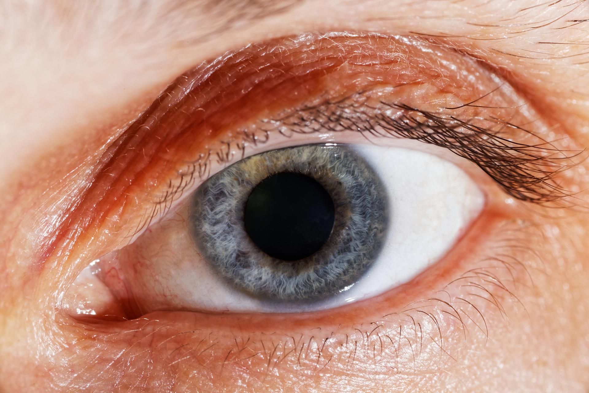 虽然无法完全预防眼睑炎的发生,但可以采取一些措施来减少患病的风险