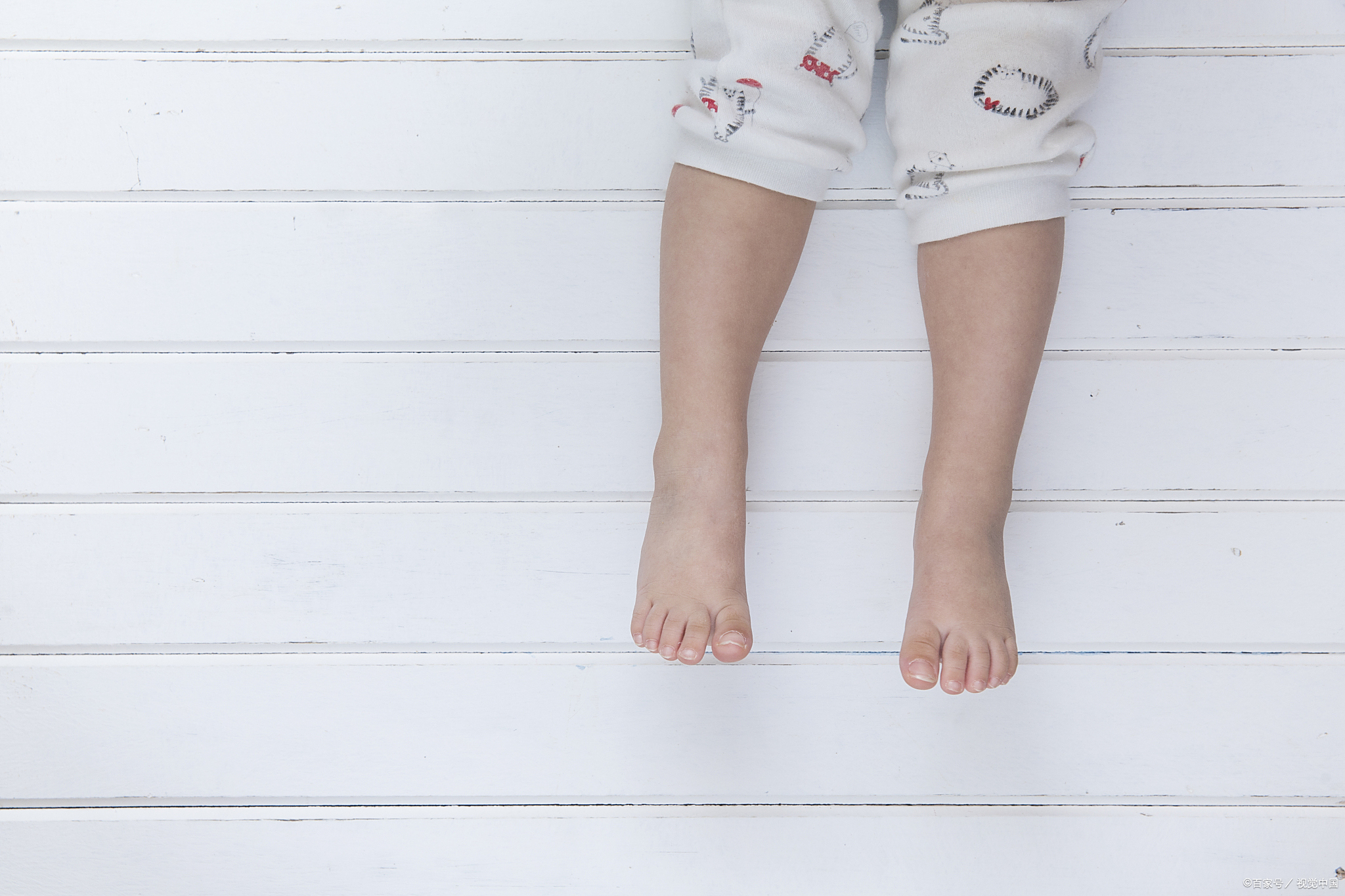 矫正儿童内八字:不要抱有侥幸心理