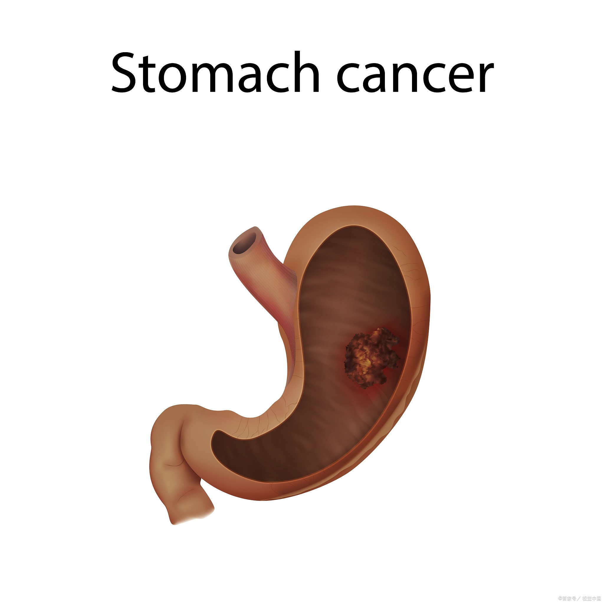 stomach的复数图片