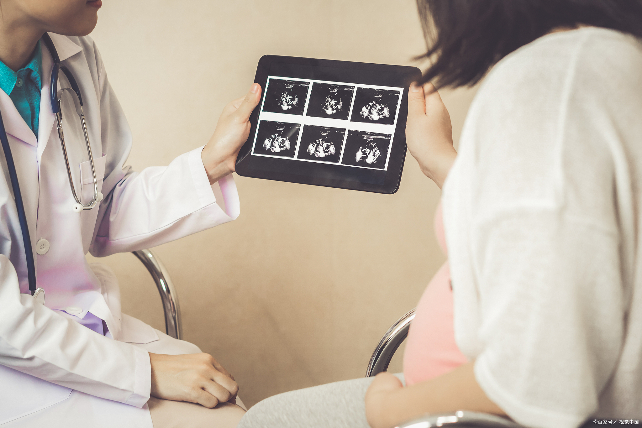 孕三项都是检查的什么?