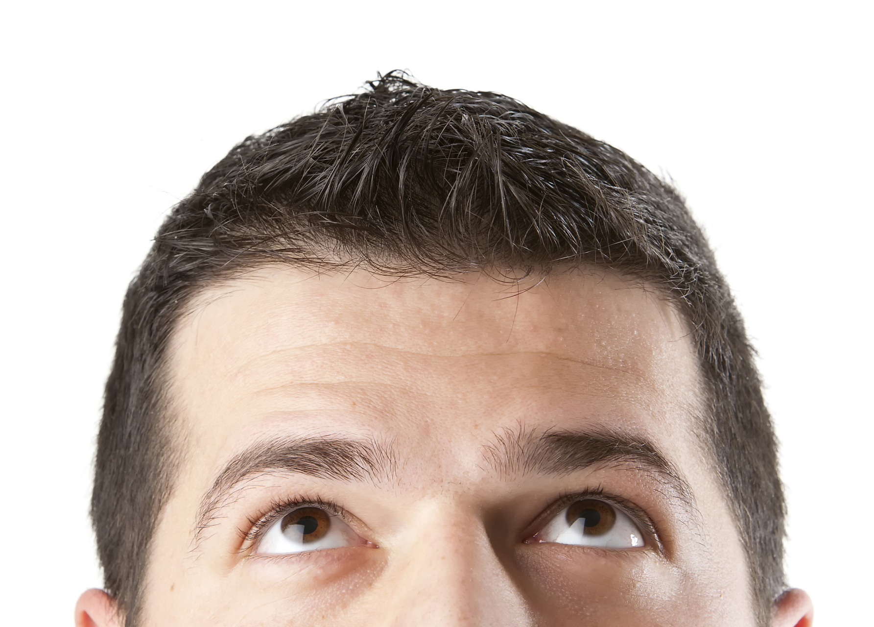 抬头纹怎么去除最有效男生 #医美# #中国医师节#   抬头纹是一种常见