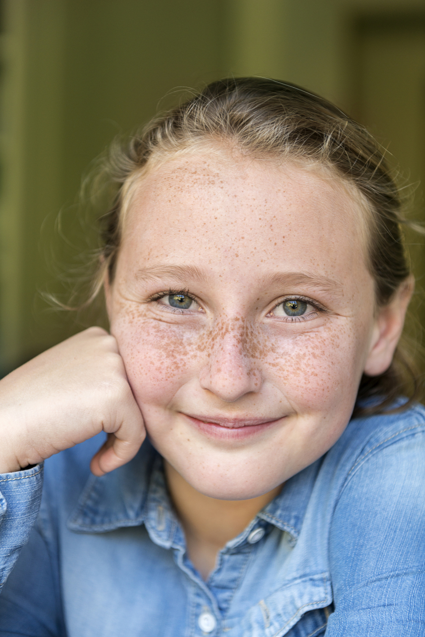 雀斑去除的最佳方法  去除雀斑的方法可以根据雀斑的程度和个体情况而