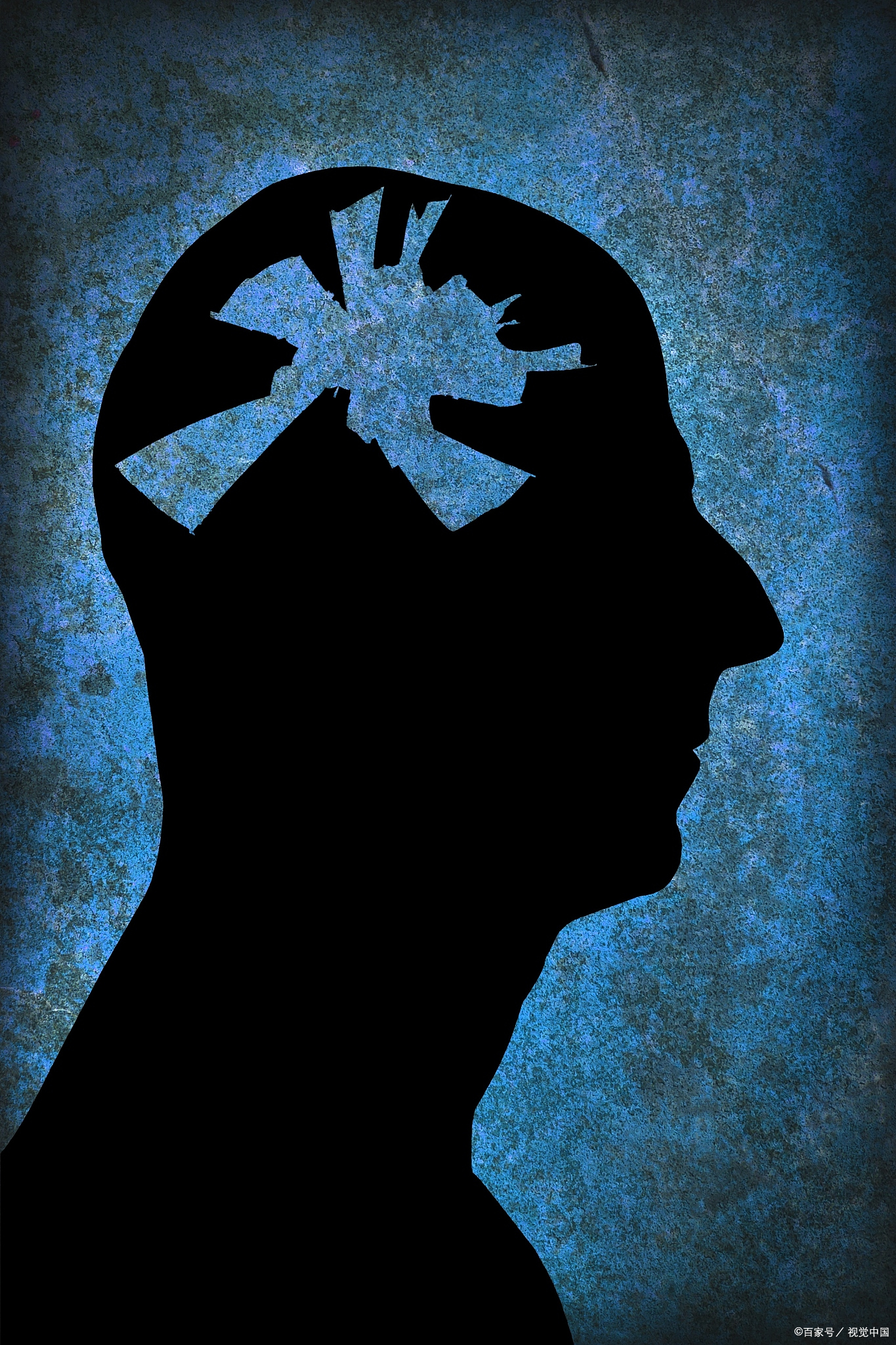 惊恐发作,也被称为急性焦虑发作,是一种突如其来