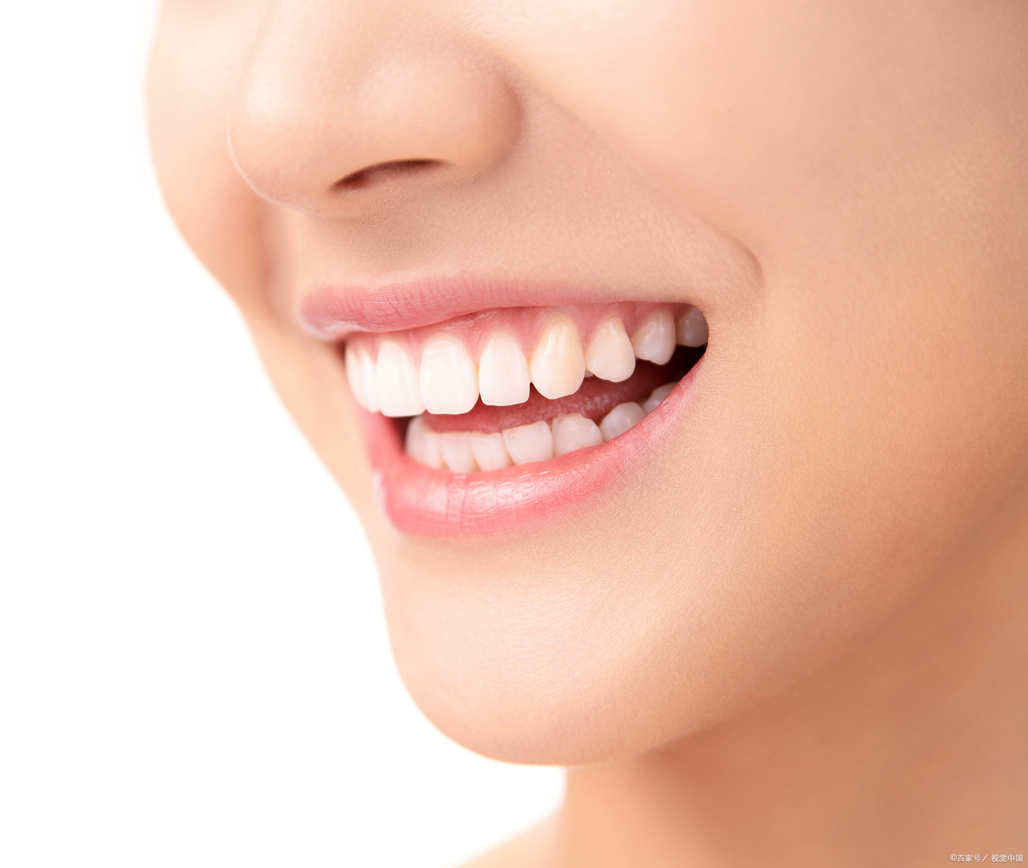 牙齿做牙套能用几年?