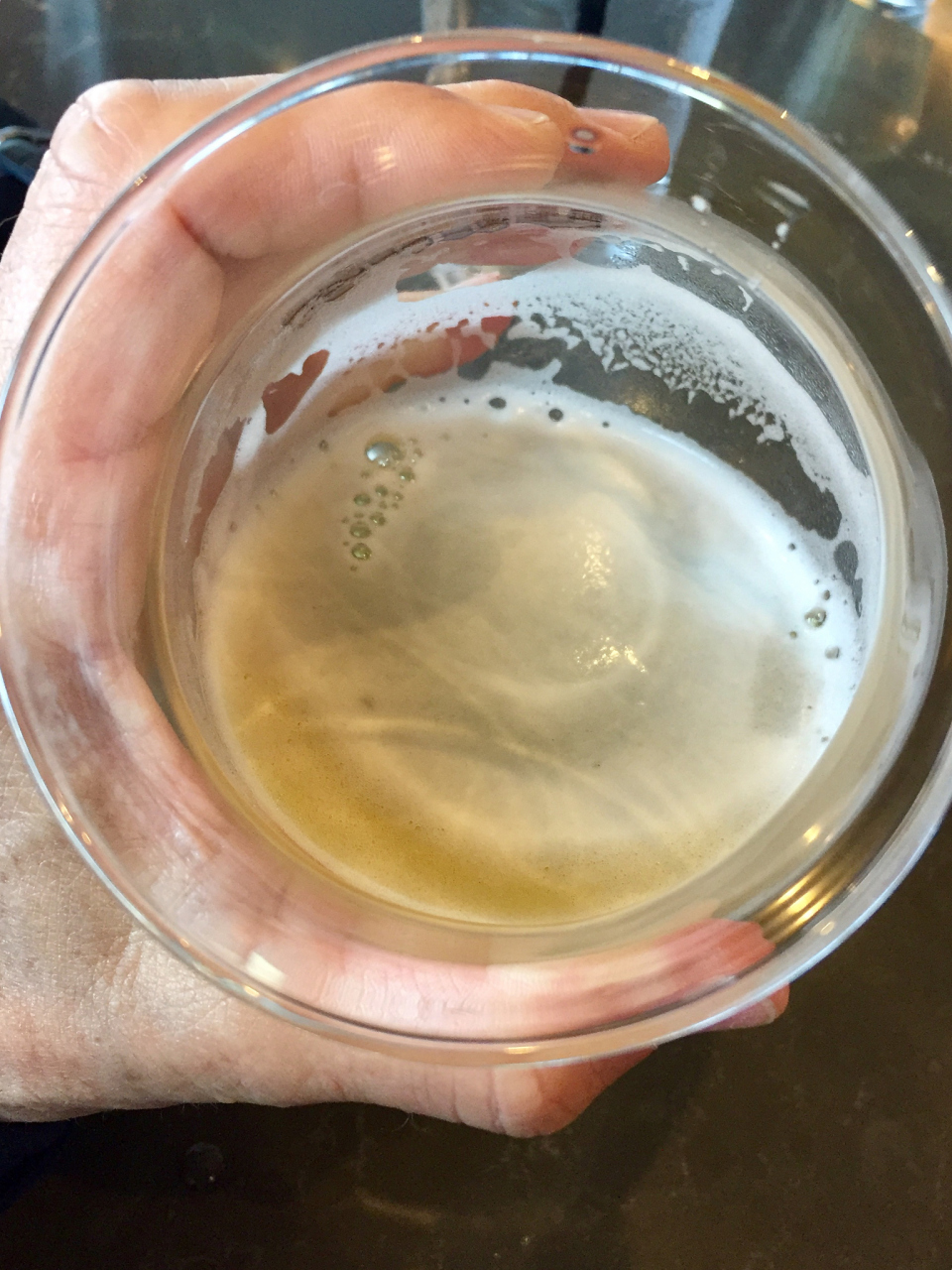 1分钟判断你的肾病好不好治    很多肾病患者都会