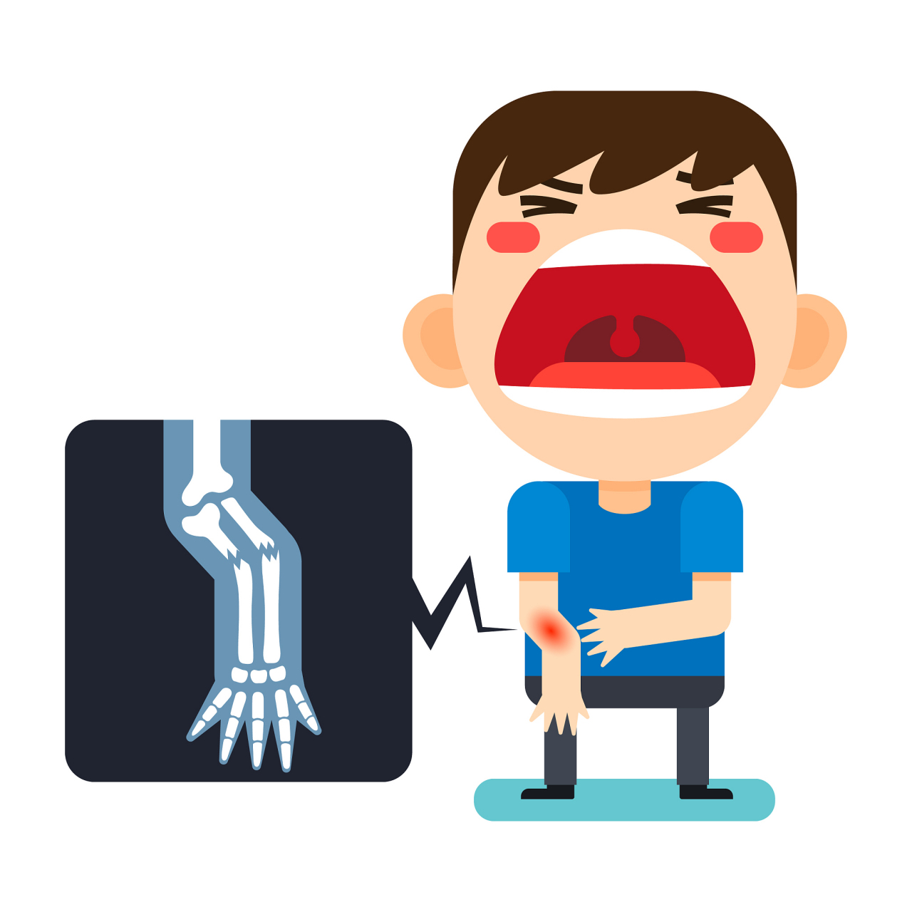 上臂成角畸形是什么骨折?  最近,我的门诊来了一位名叫张先生的患者.