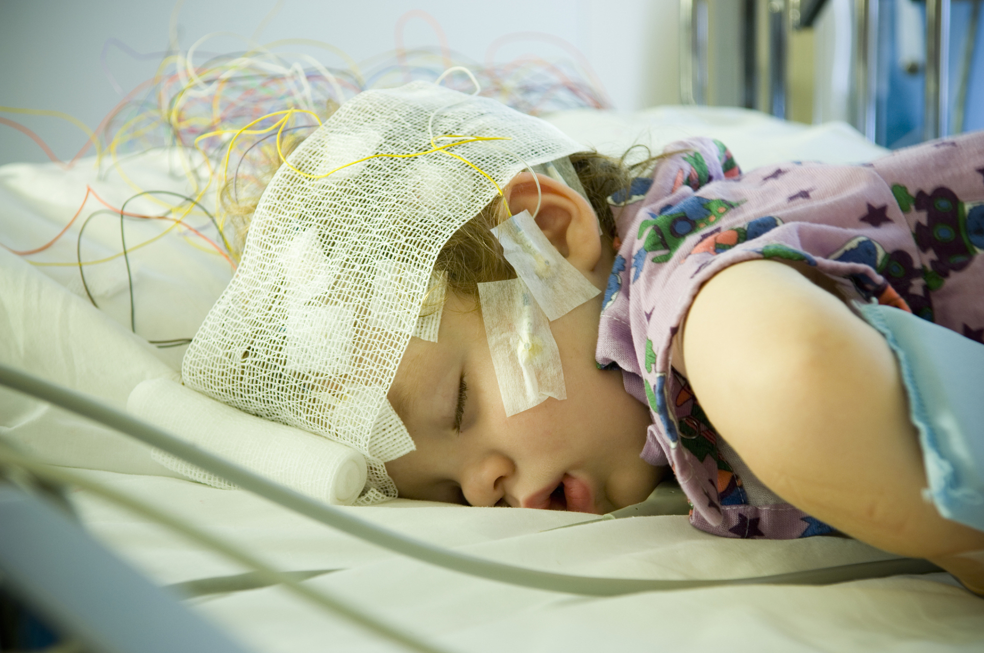 癫痫需要进行综合性的医学评估,包括临床症状,脑电图