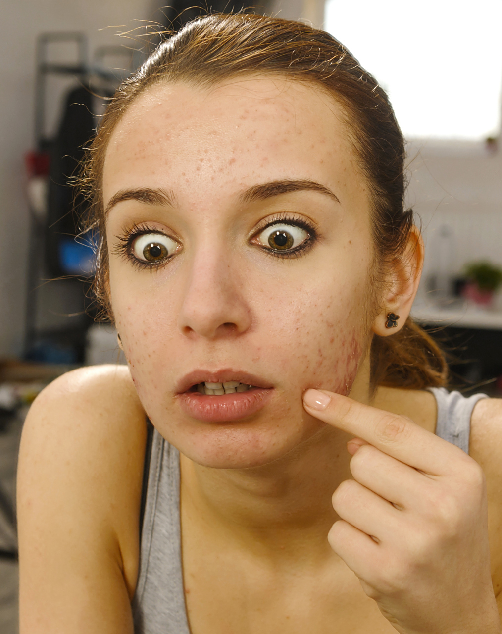 脸色发黄暗沉长斑怎么调理?