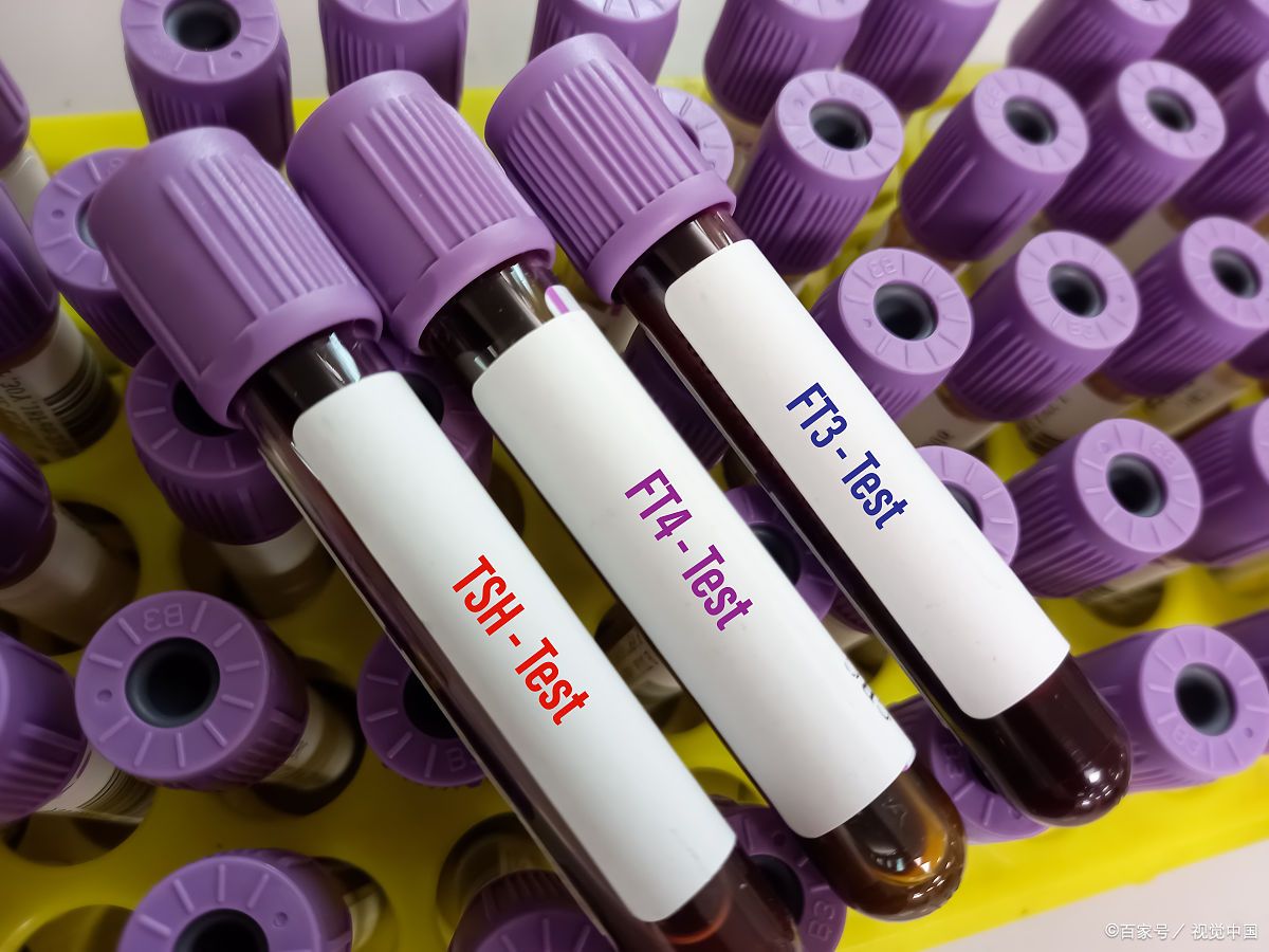 甲状腺球蛋白(tg)有.@乳甲外科曹卫刚医生的动态