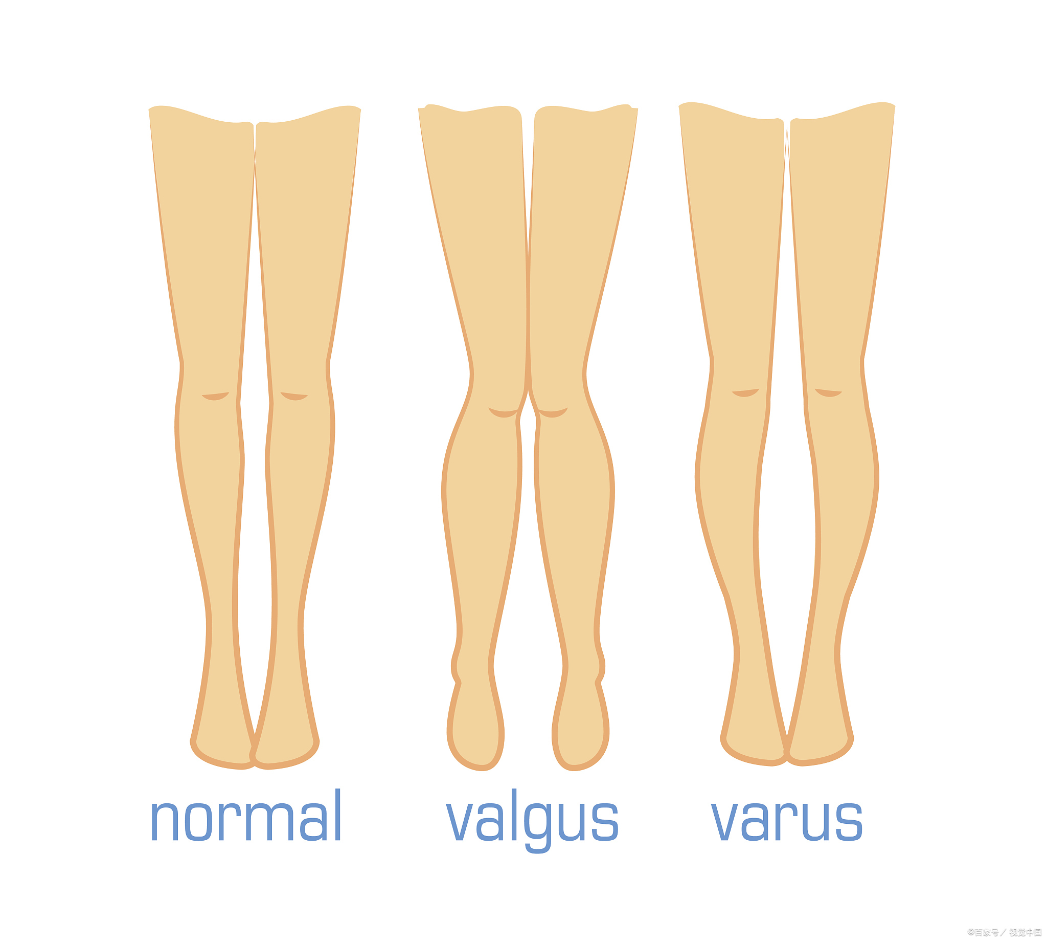 正常的腿型图图片