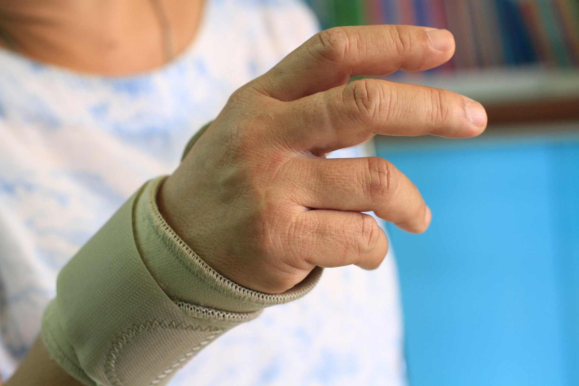 脑梗后为何会引起手掌挛缩?