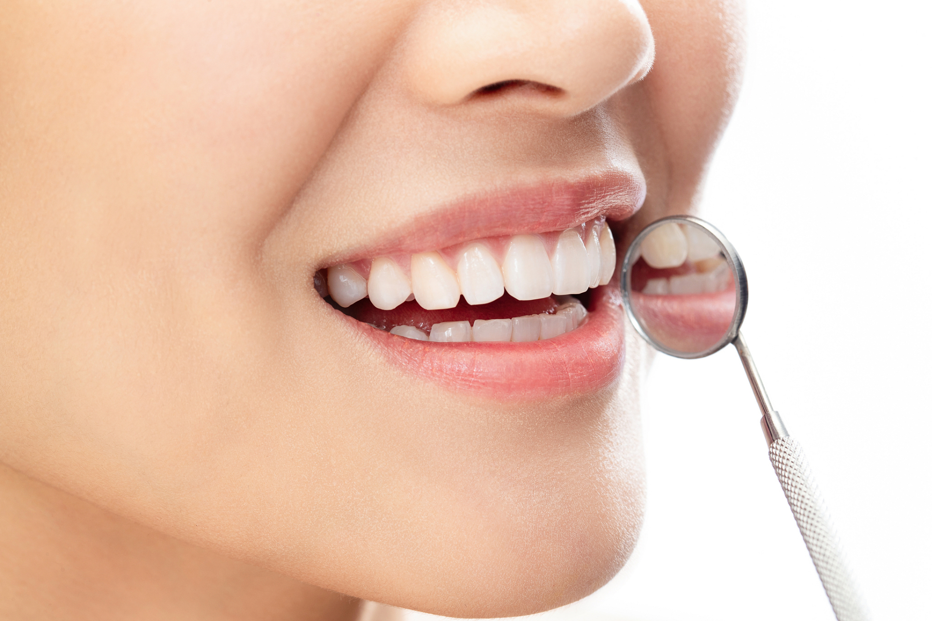 牙齿贴片美白疼么?