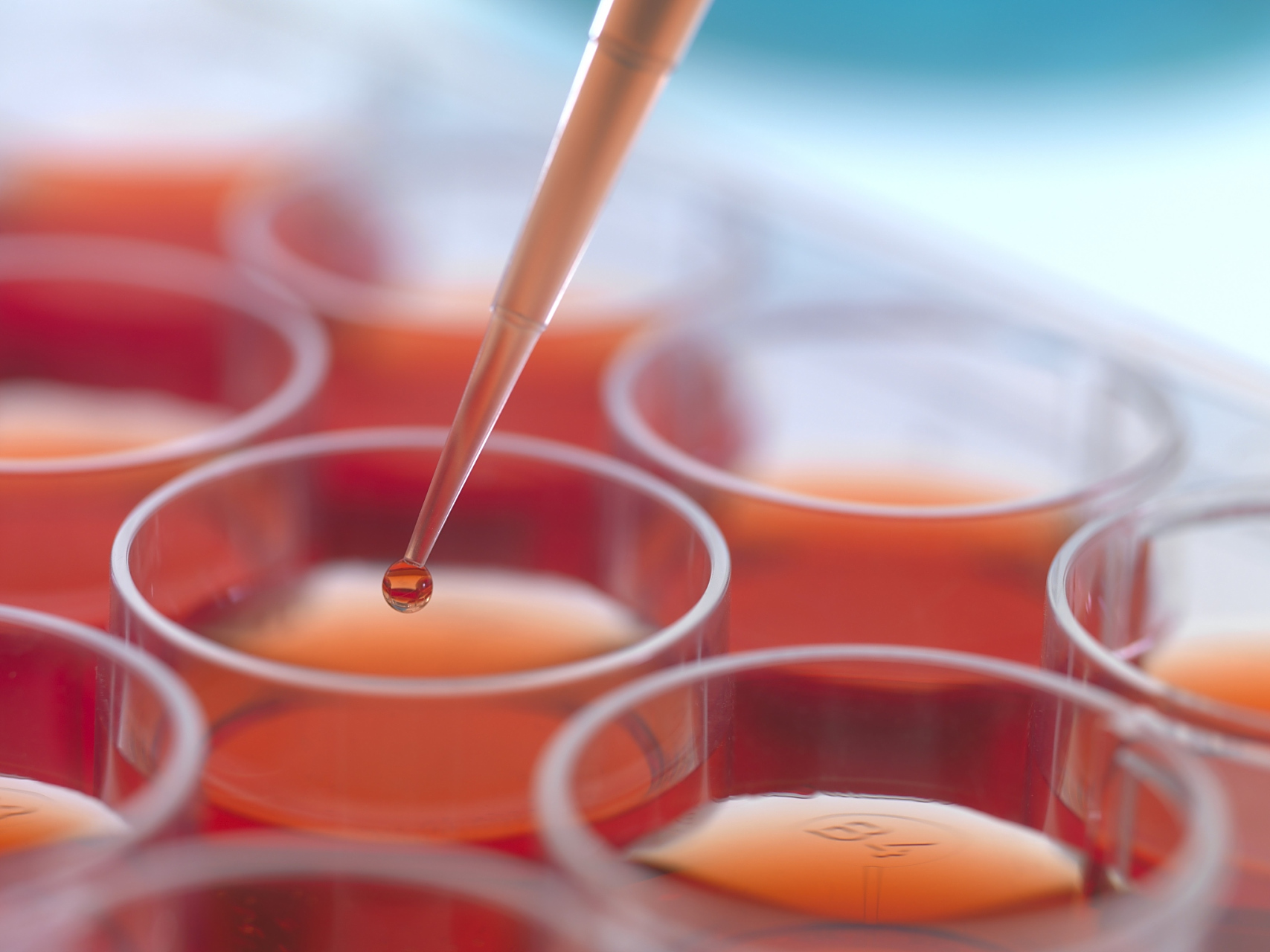 高中生物制备培养基(高中生物培养基用什么方法灭菌) 第1张 高中生物制备培养基(高中生物培养基用什么方法灭菌) 第1张