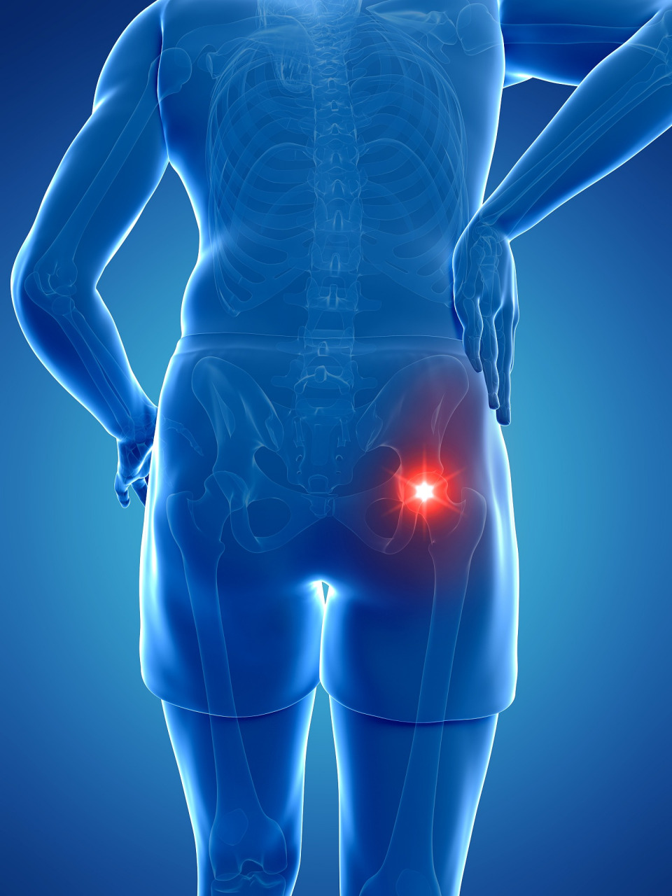胯骨疼,不再是你的困扰!