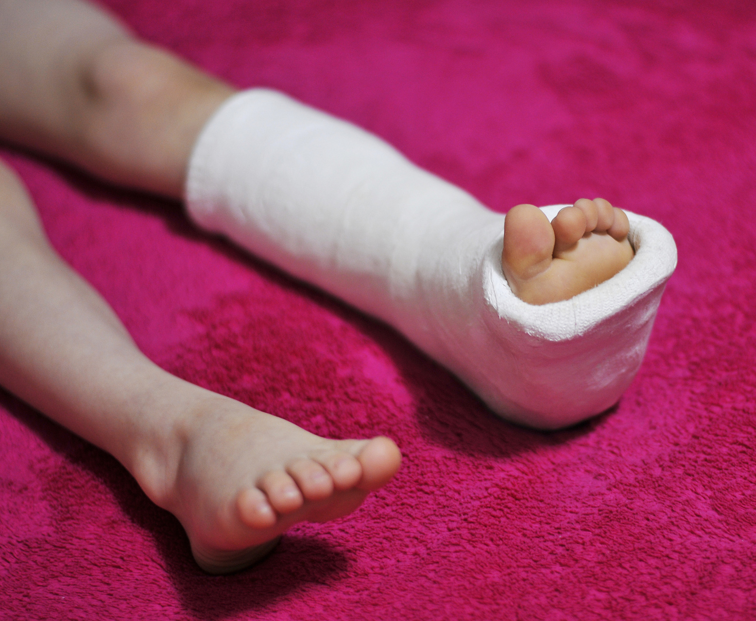 摘要: 孩子小腿骨折的康复时间因多种因素而异,一般需要6-8周.