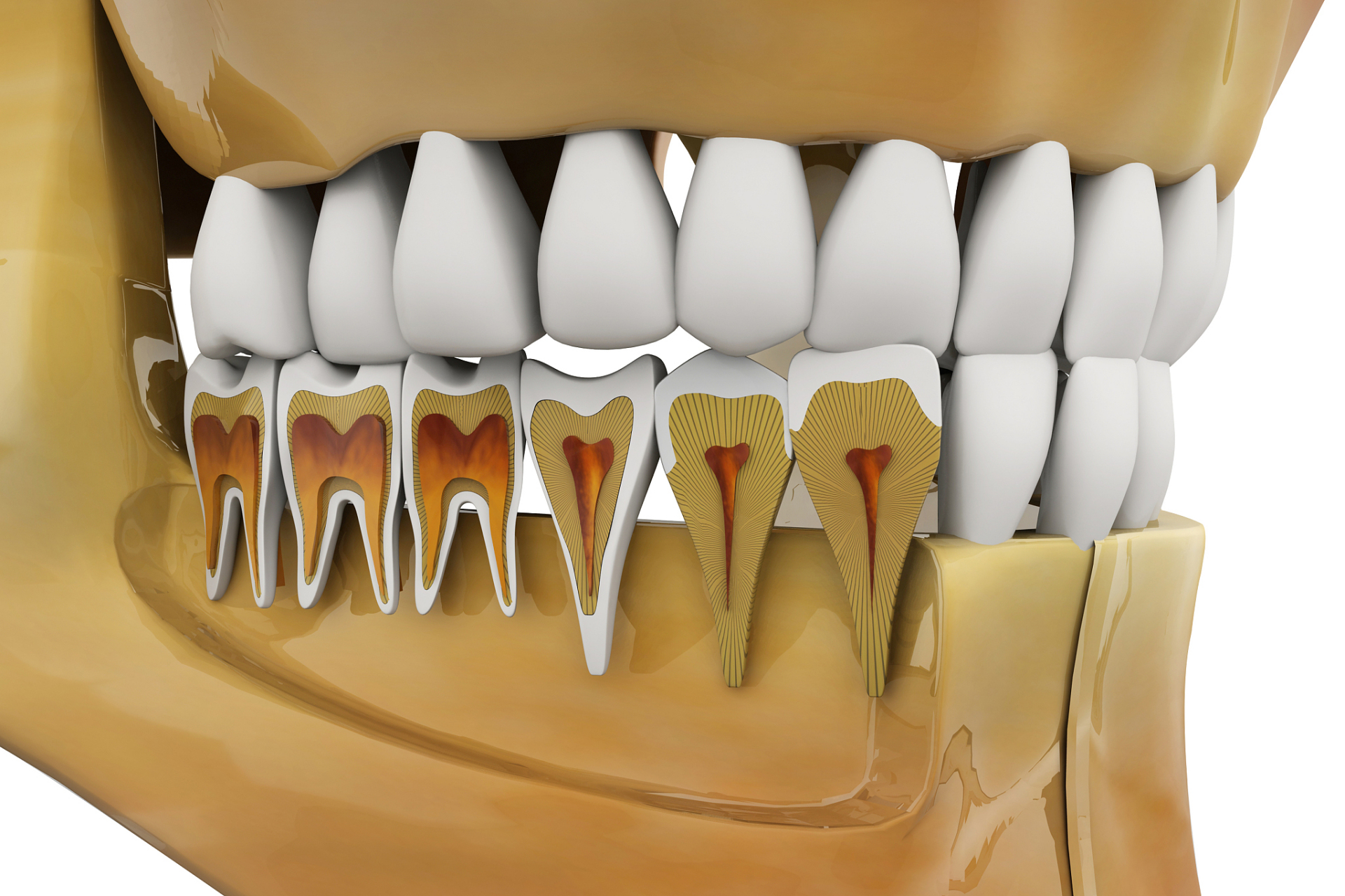 它分为两个主要阶段:牙龈炎和牙周炎.