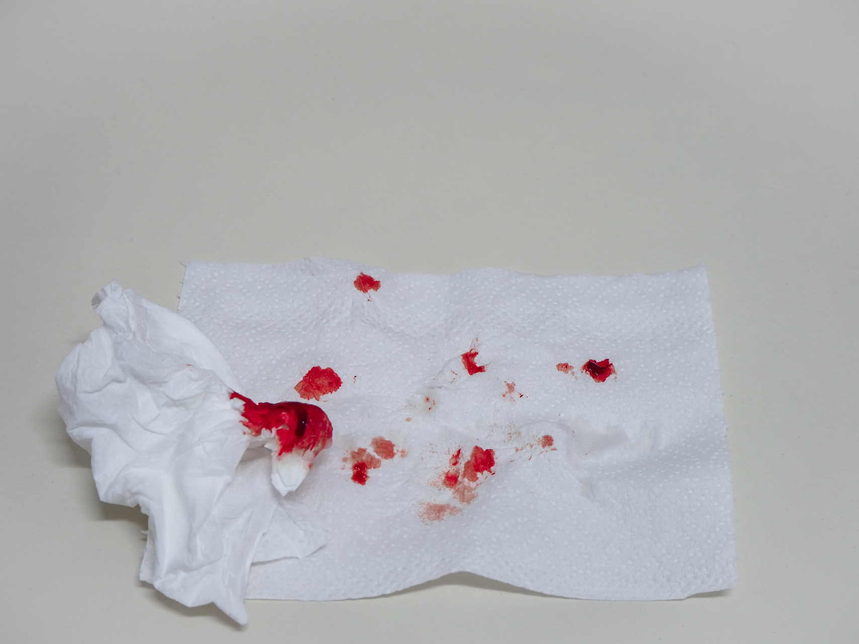 结核菌可侵袭肺部组织,导致肺部感染,使咳嗽时出现带血痰液.