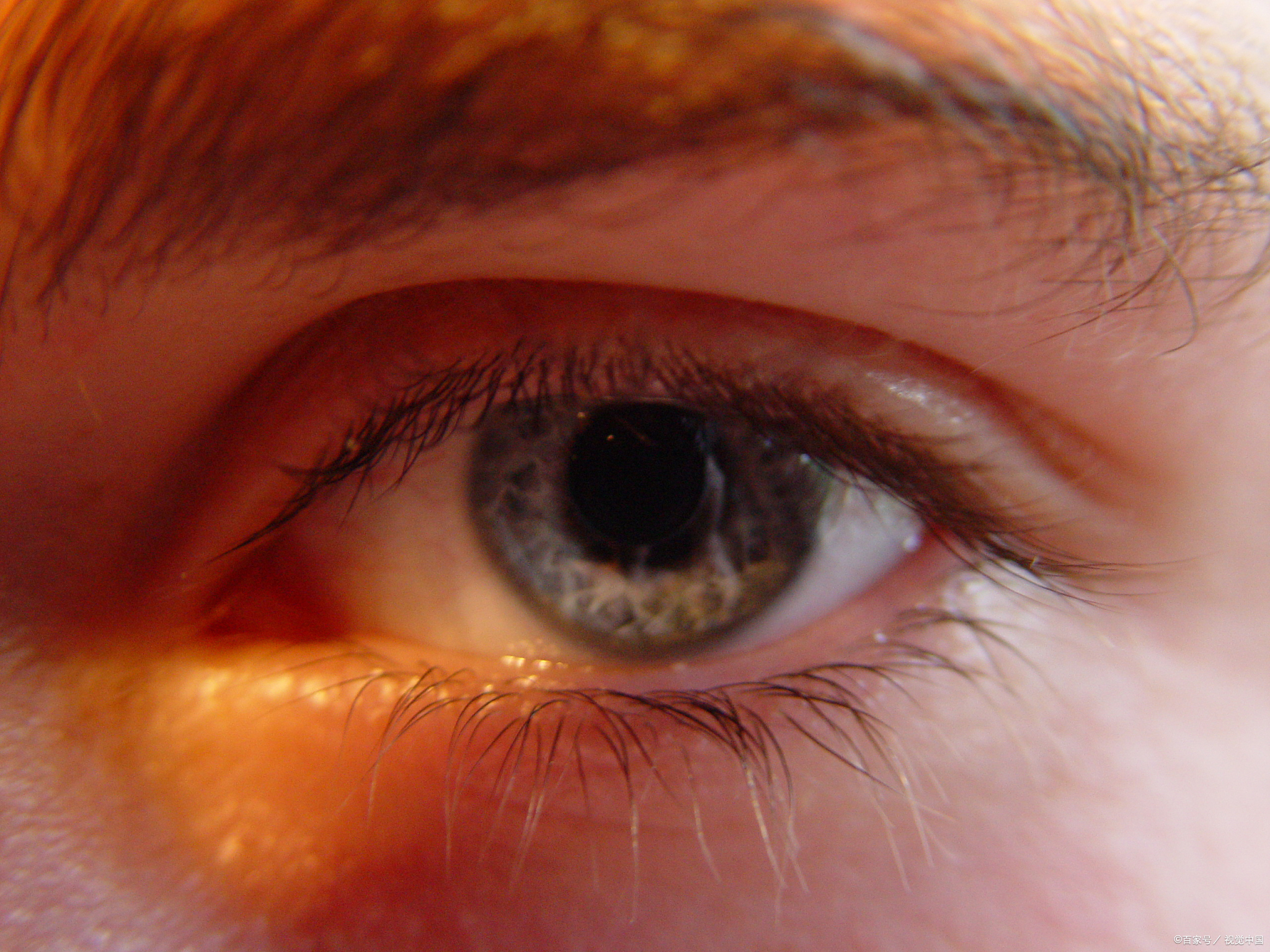 眼睛为什么会模糊 眼睛为什么会模糊