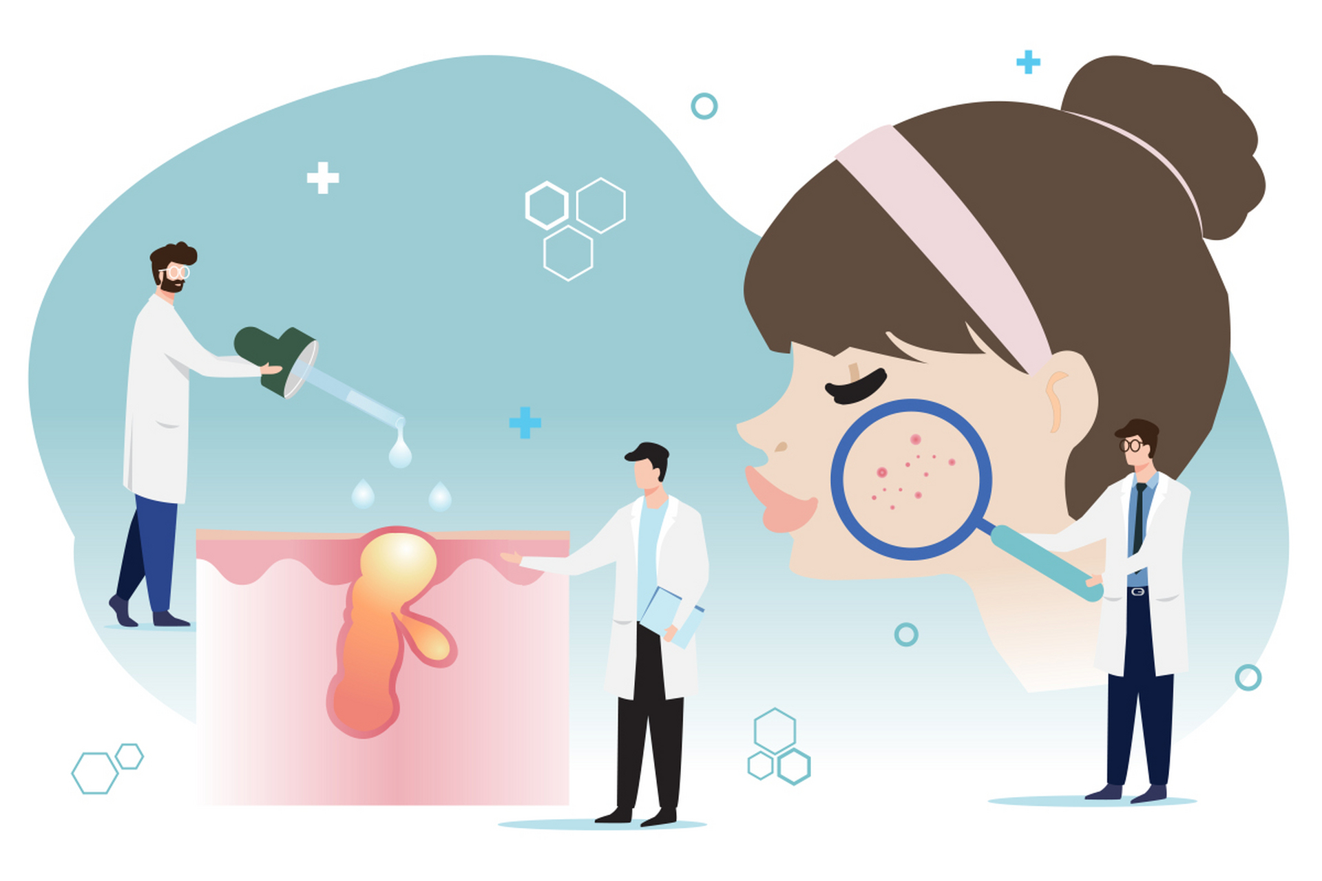 痤疮的发病原因!