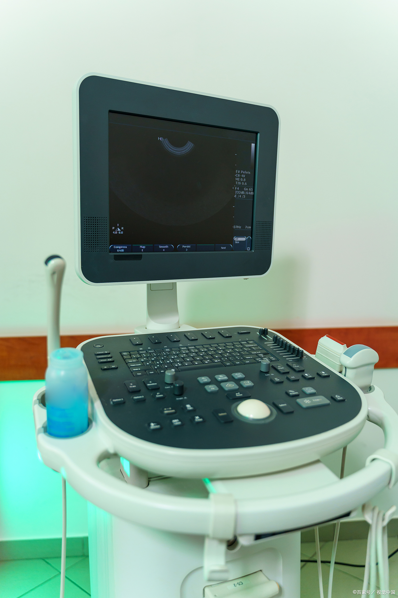 有经验的妇科超声医生可