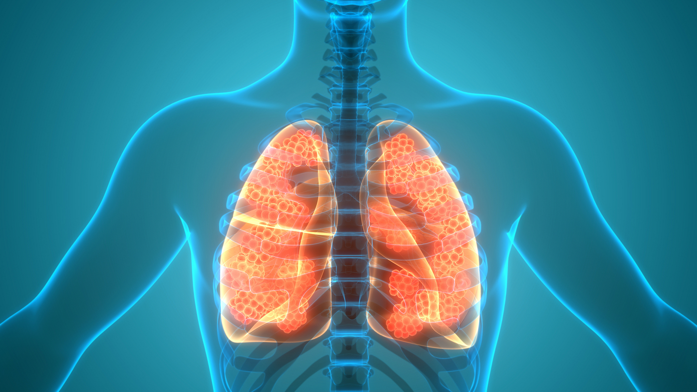 我们需要引起警惕  很多人体检发现了肺结节,每个人肺结节的位置和