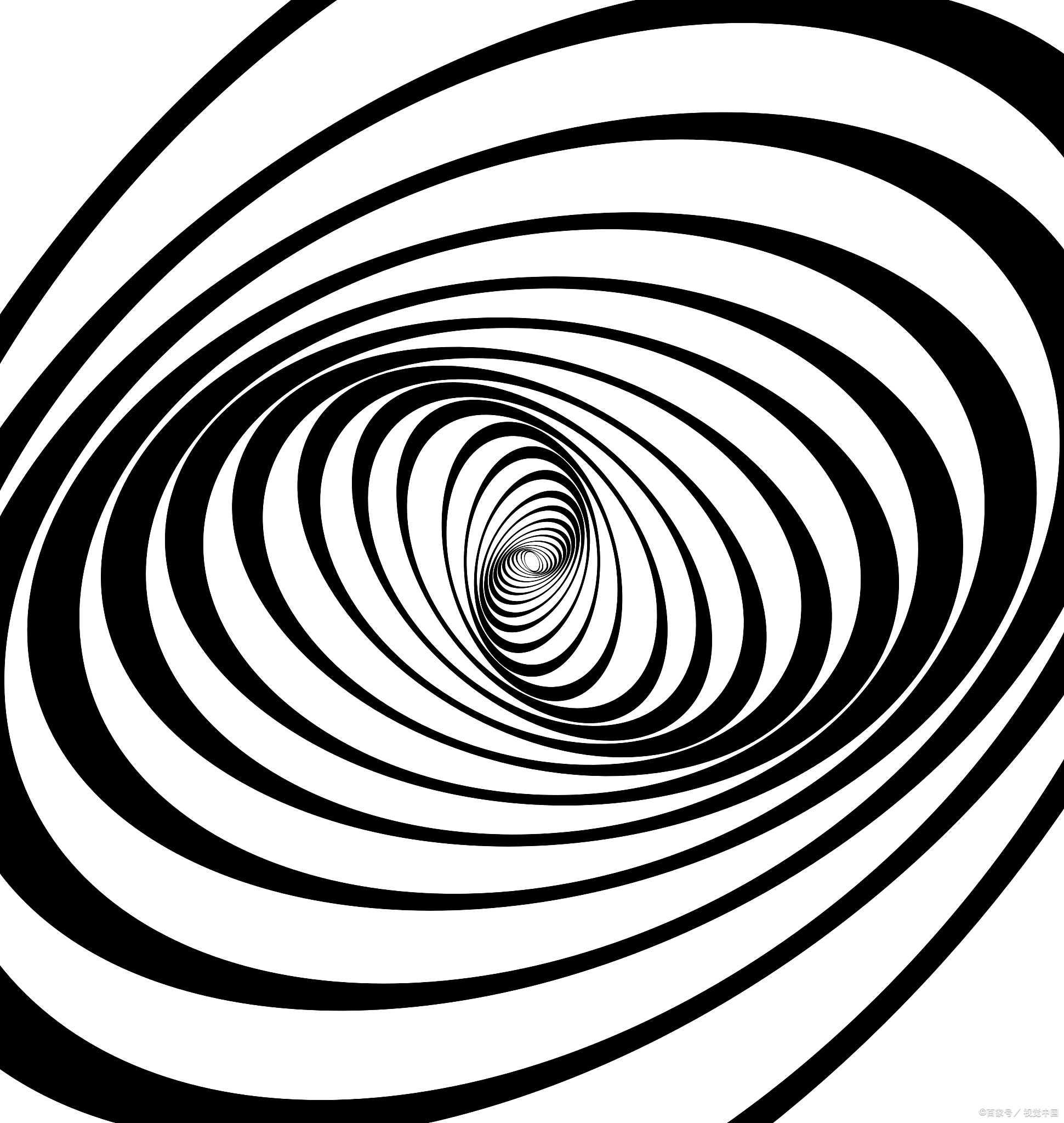 系统性眩晕:是前庭系统病变引起,是眩晕的主要病因,可伴眼球震颤,平衡