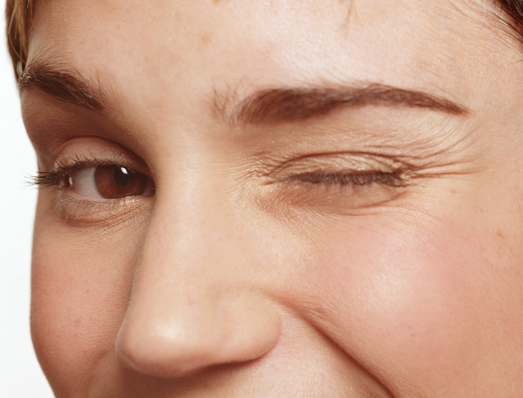 眼睛下有一道纹是什么纹  眼睛下面的纹路可能是眼下细纹或眼下横纹.