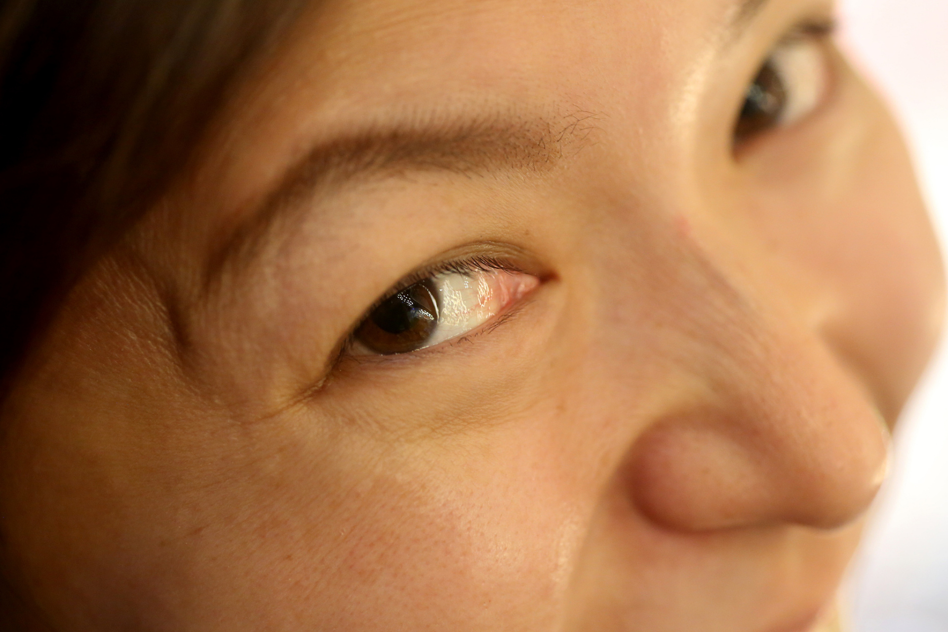 眼睛为什么不受控制向上翻  眼睛不由自主往上翻,可能是由于抽动症