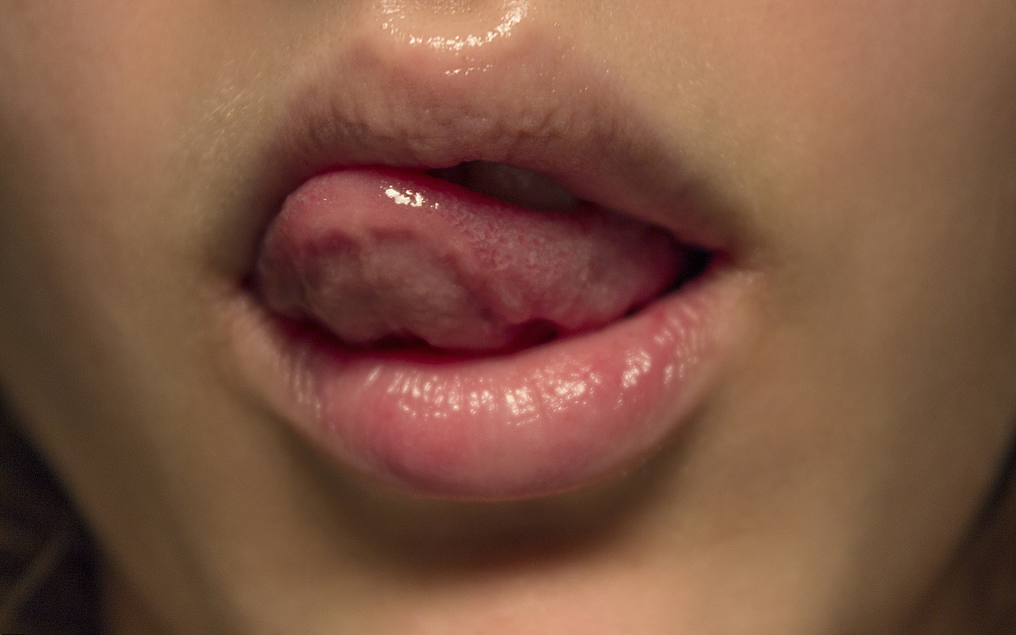 正常人舌头上有红点吗	正常情况下,舌头上有红点属于正常,散在的红点