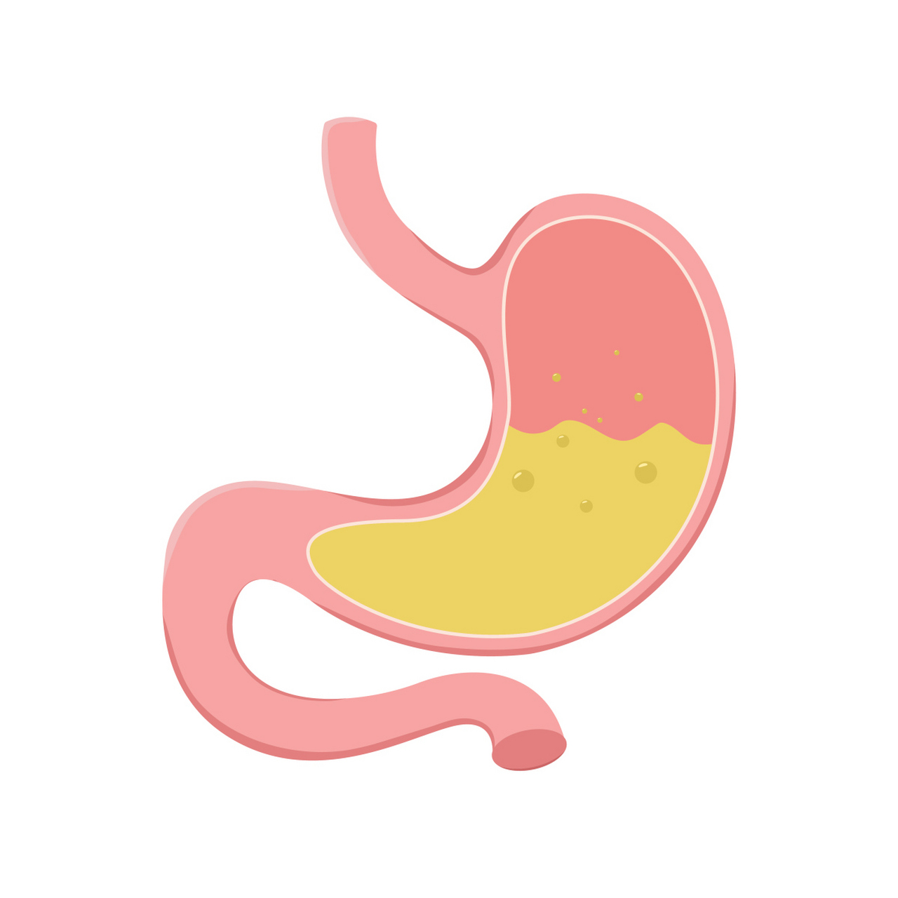 胃病新药——艾司奥美拉唑镁碳酸氢钠胶囊(海悦美奥)怎么样?