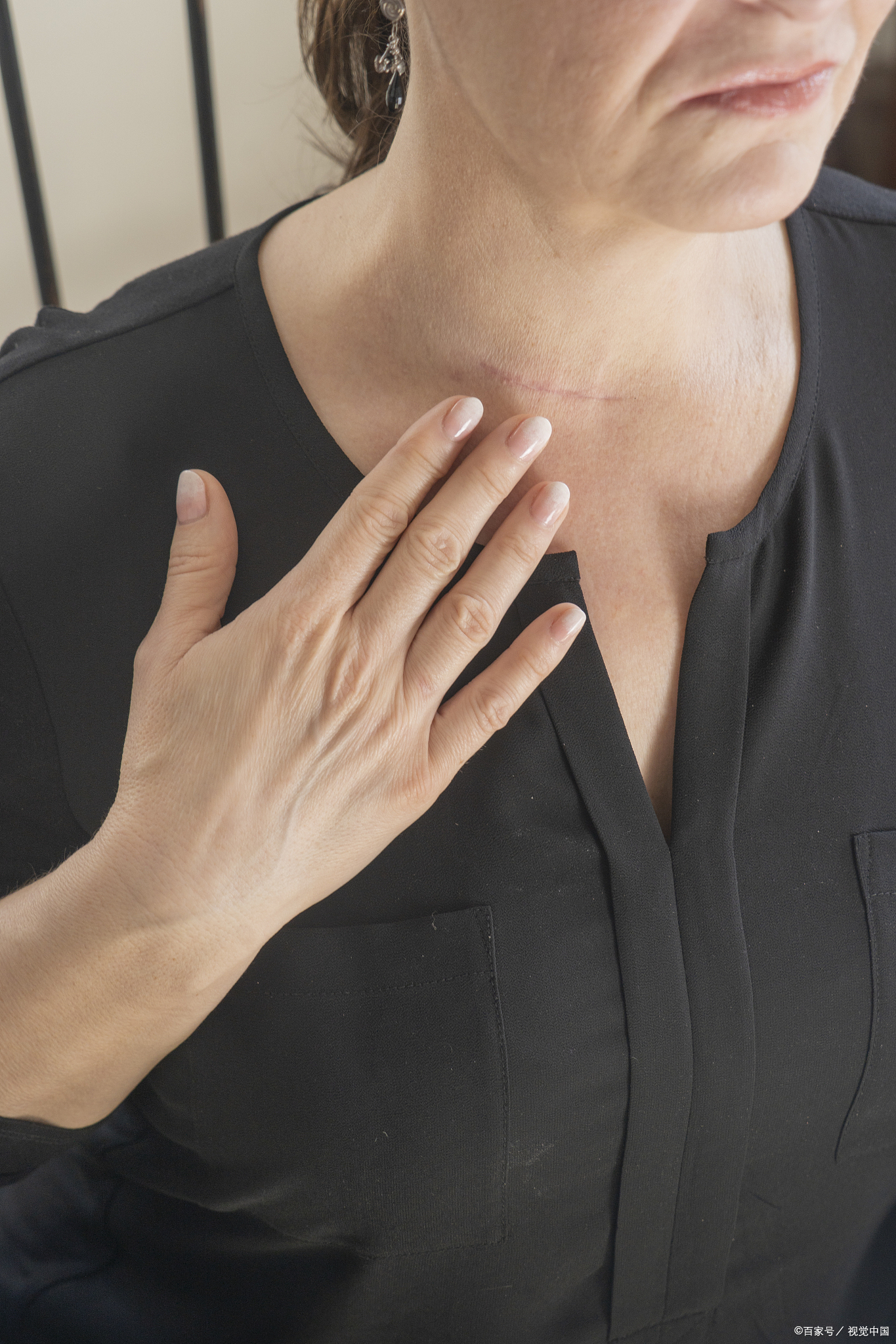 女右锁骨处疼,怎么缓解?